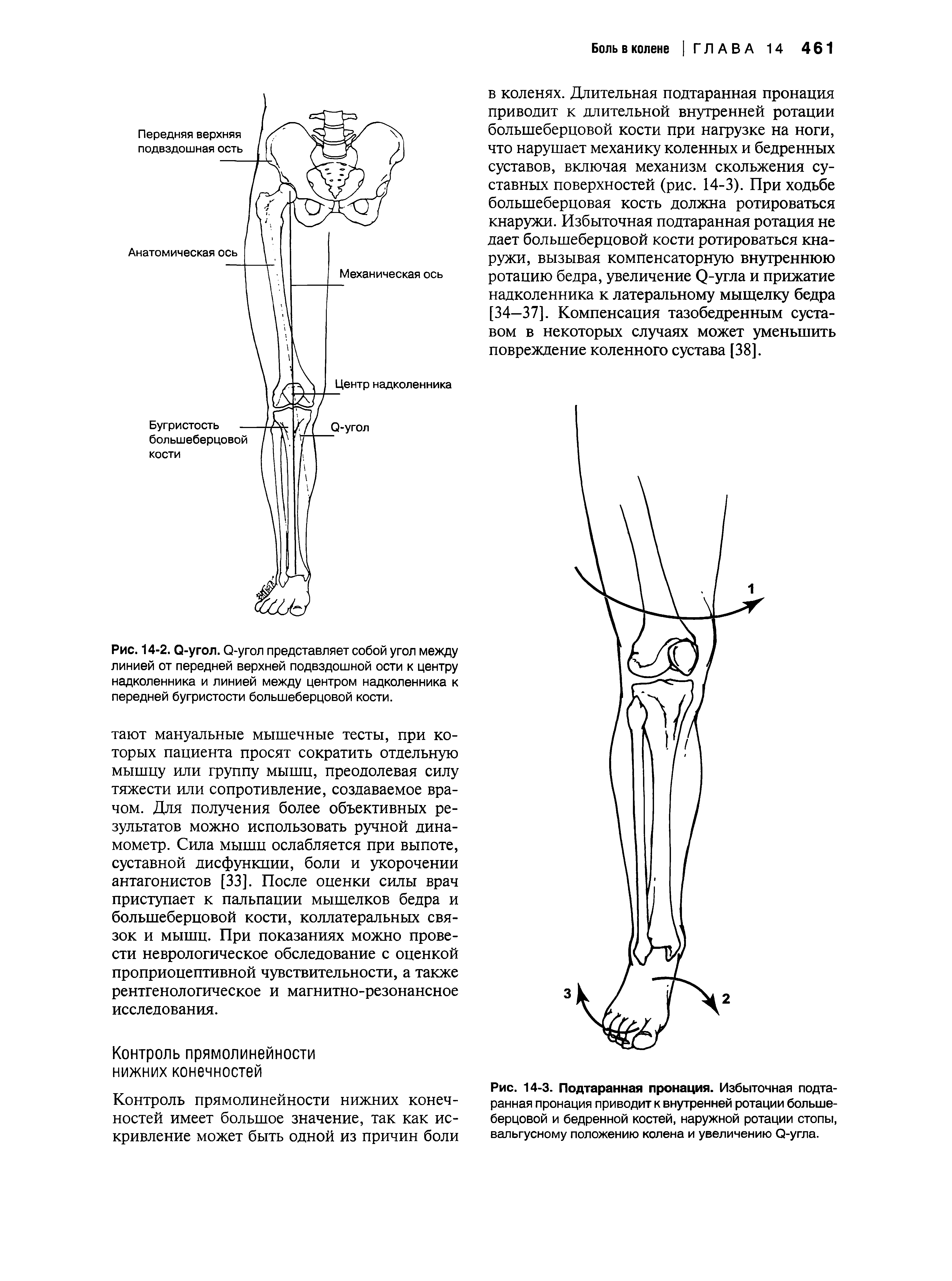 Рис. 14-3. Подтаранная пронация. Избыточная подтаранная пронация приводит к внутренней ротации большеберцовой и бедренной костей, наружной ротации стопы, вальгусному положению колена и увеличению О-угла.