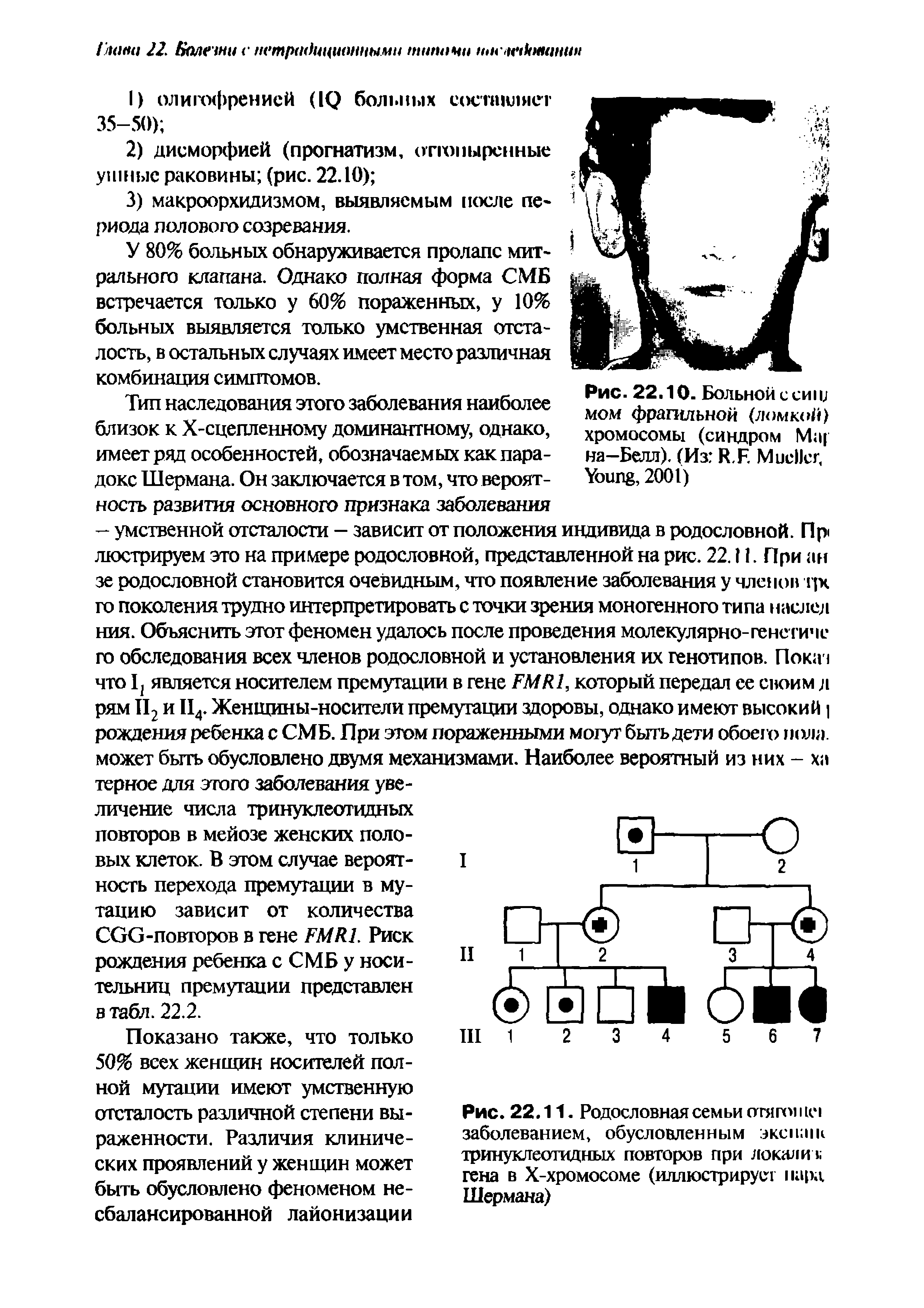 Рис. 22.11. Родословная семьи заболеванием, обусловленным эксшик тринуклеотидных повторов при докали и гена в Х-хромосоме (иллюстрирует нард Шермана)...