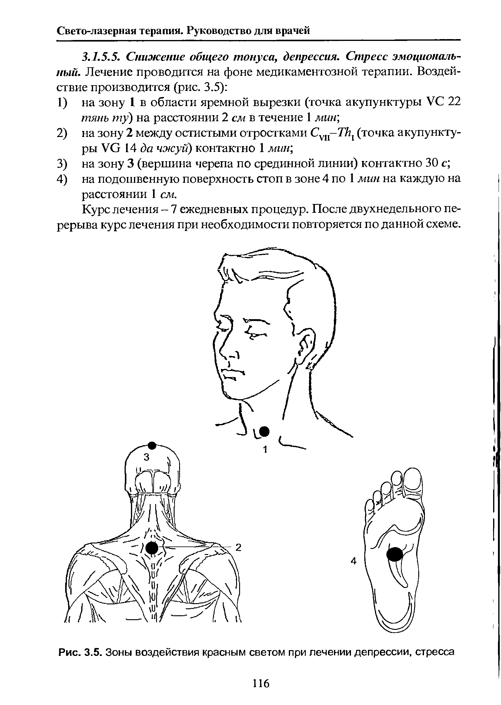 Рис. 3.5. Зоны воздействия красным светом при лечении депрессии, стресса...