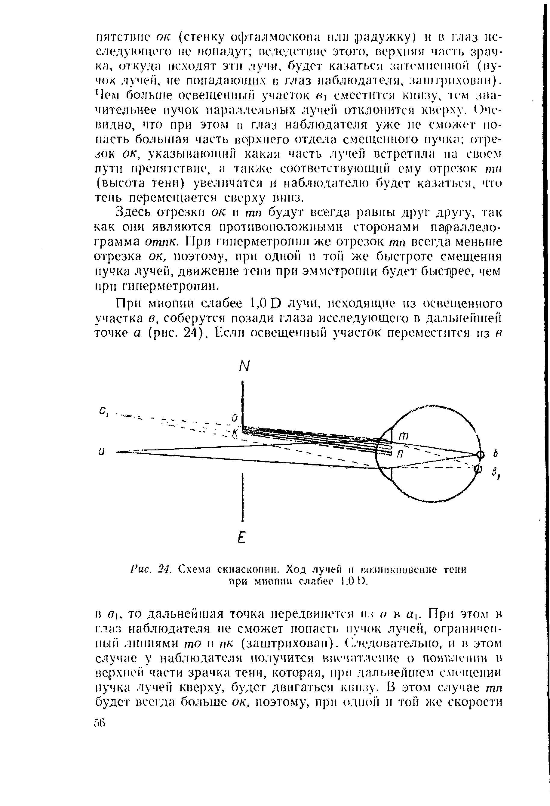 Рис. 24. Схема скиаскопии. Ход лучей и возникновение тени при миопии слабее 1.01).