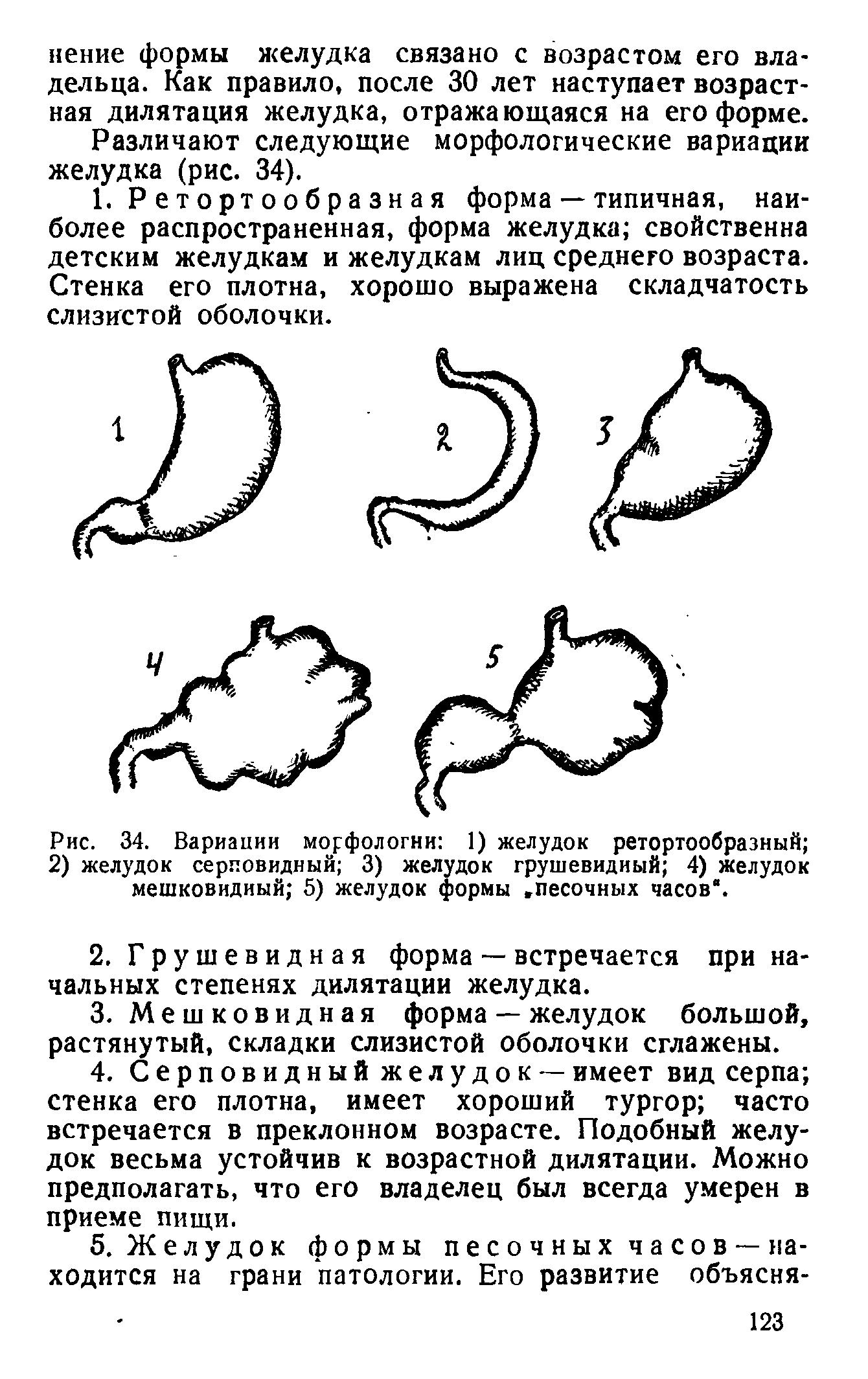 Рис. 34. Вариации морфологии 1) желудок ретортообразный 2) желудок серповидный 3) желудок грушевидный 4) желудок мешковидный 5) желудок формы. песочных часов .