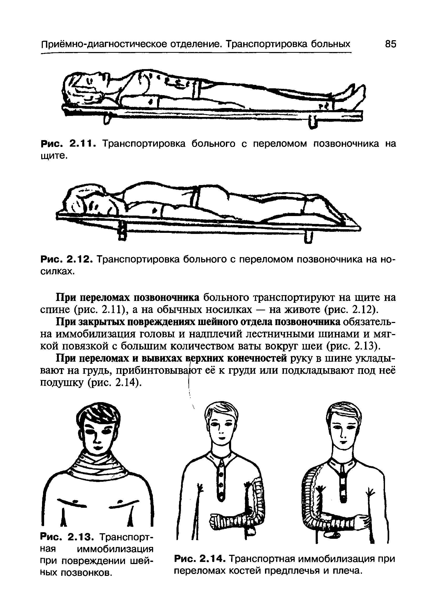 Рис. 2.14. Транспортная иммобилизация при переломах костей предплечья и плеча.