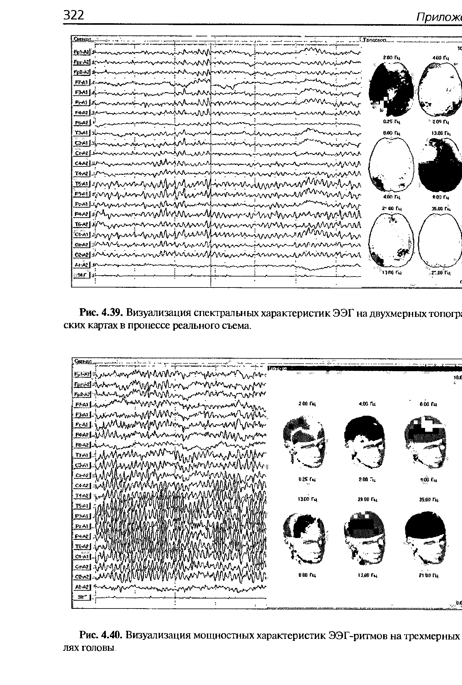 Рис. 4.39. Визуализация спектральных характеристик ЭЭГ на двухмерных топогр ских картах в процессе реального съема.