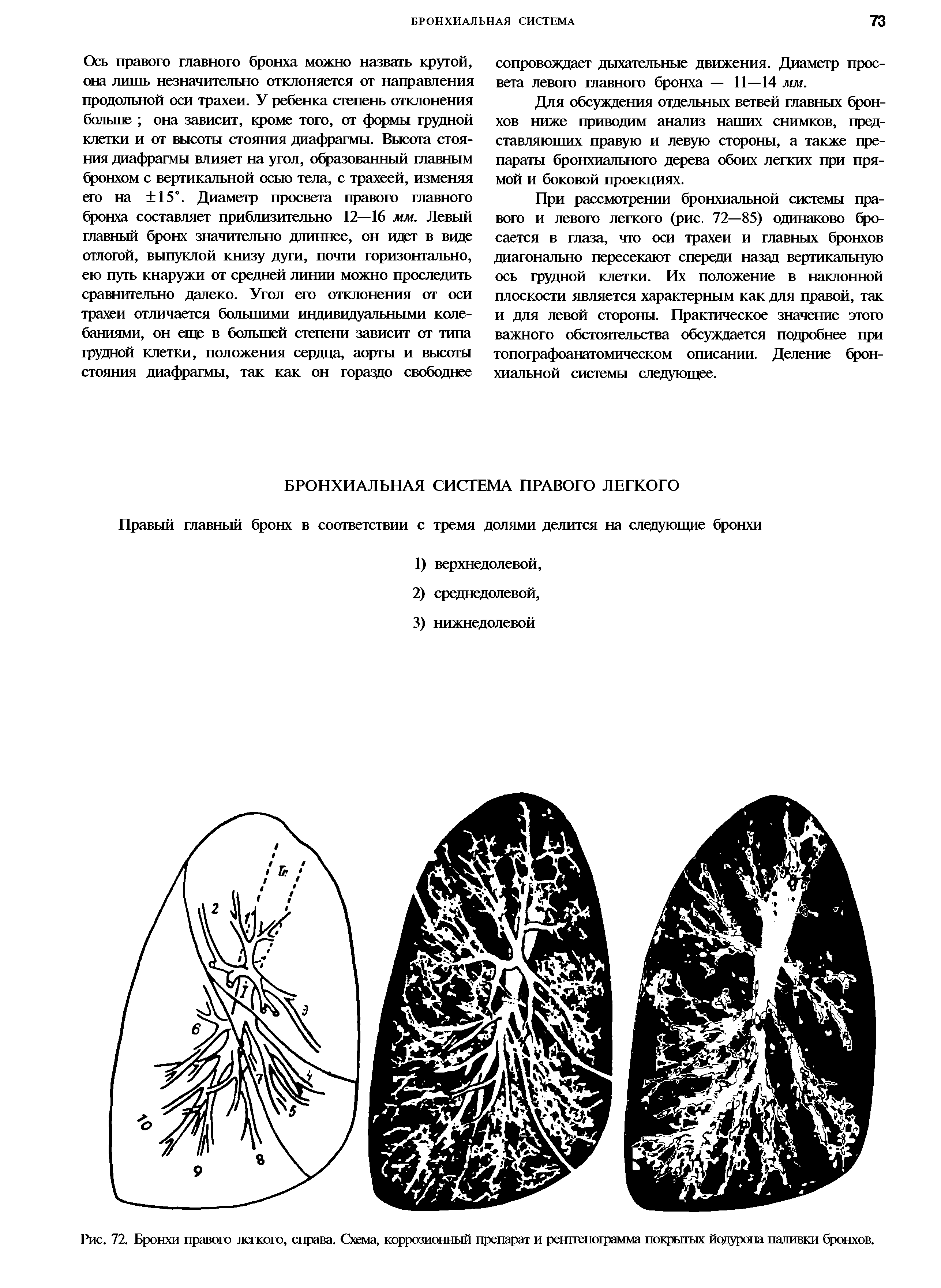 Рис. 72. Бронхи правого легкого, справа. Схема, коррозионный препарат и рентгенограмма покрытых йодурона наливки бронхов.