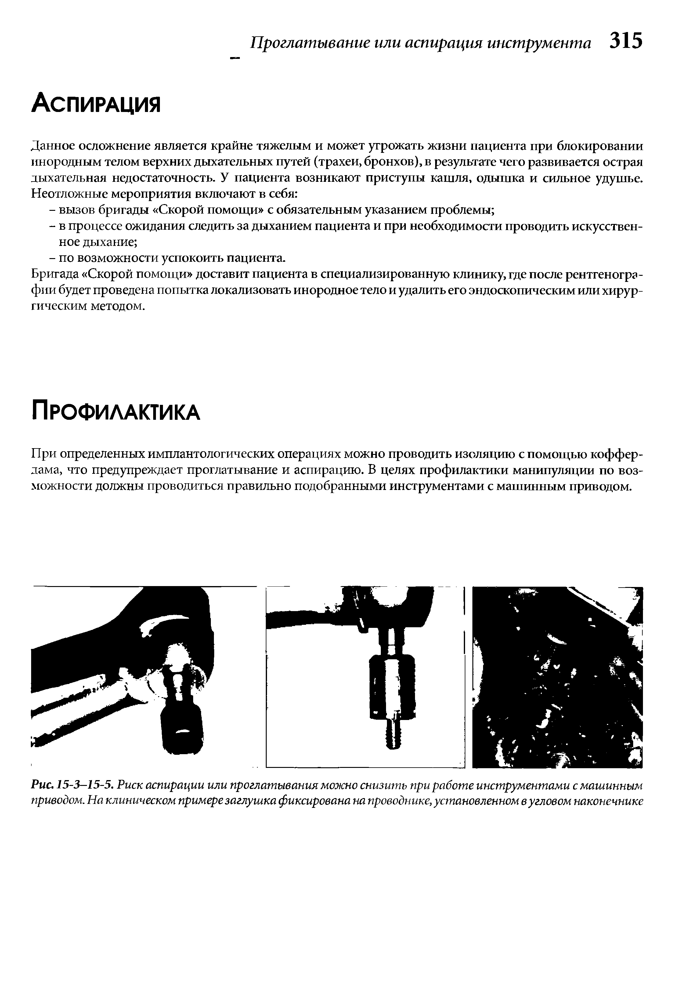 Рис. 15-3-15-5. Риск аспирации или проглатывания можно снизить при работе инструментами с машинным приводом. На клиническом примере заглушка фиксирована на проводнике, установленном в угловом наконечнике...