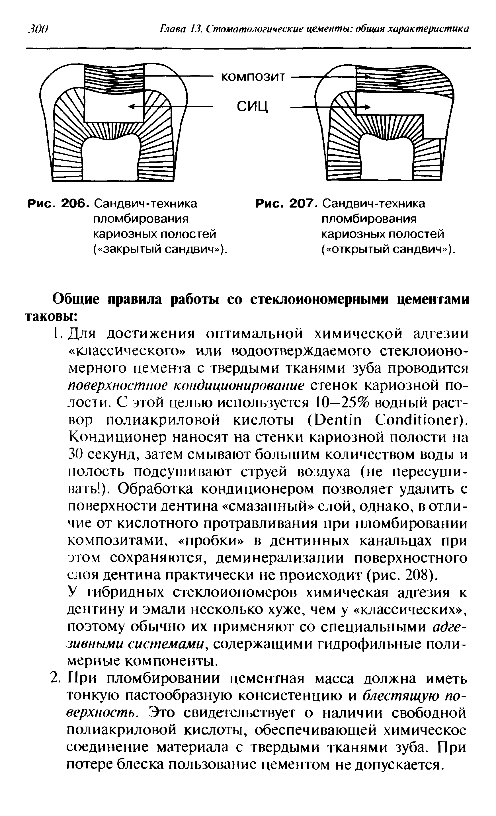 Рис. 207. Сандвич-техника пломбирования кариозных полостей ( открытый сандвич )...