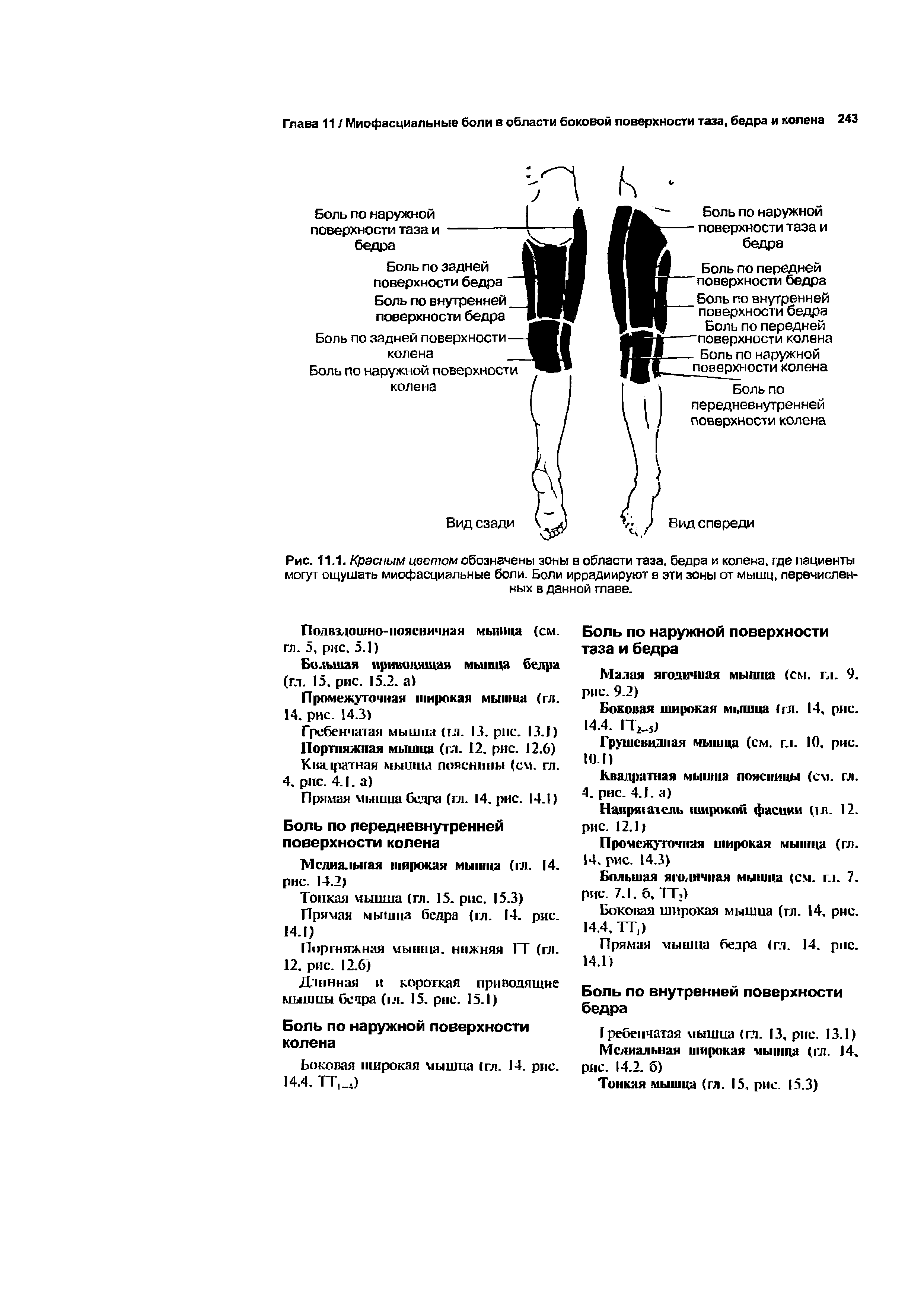 Рис. 11.1. Красным цветом обозначены зоны в области таза, бедра и колена, где пациенты могут ощушать миофасциальные боли. Боли иррадиируют в эти зоны от мышц, перечисленных в данной главе.