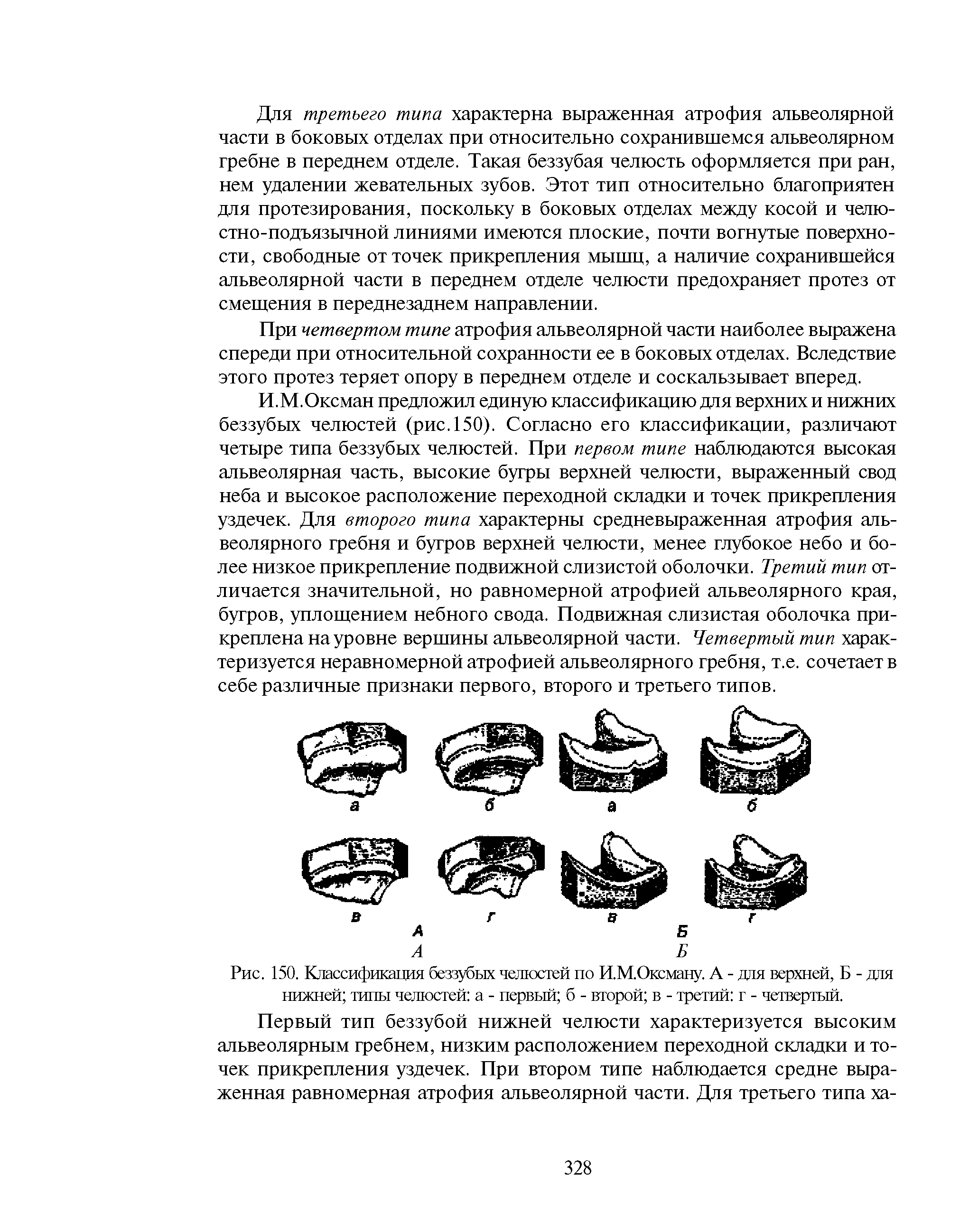 Рис. 150. Классификация беззубых челюстей по И.М.Оксману. А - для верхней, Б - для нижней типы челюстей а - первый б - второй в - третий г - четвертый.