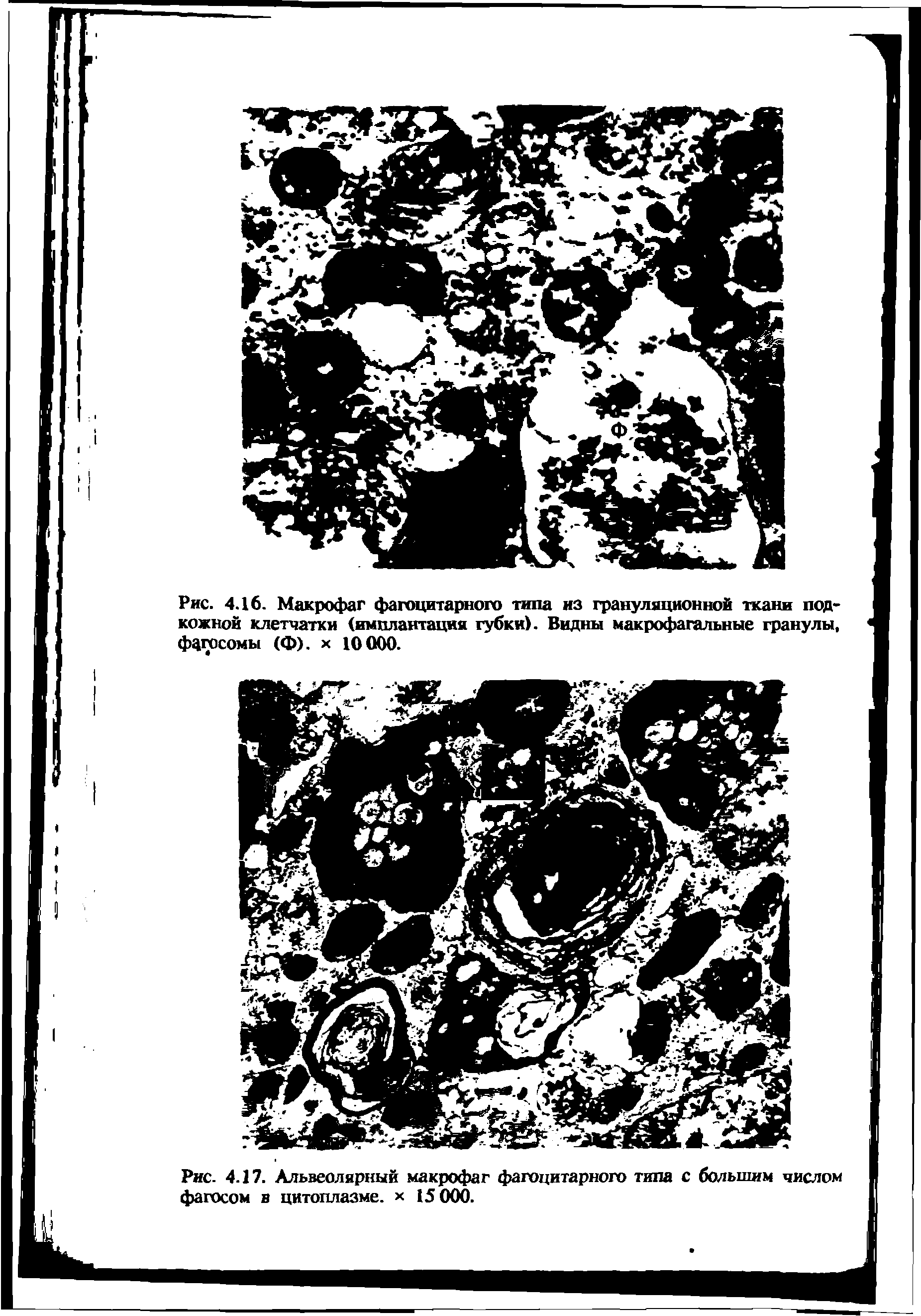 Рис. 4.16. Макрофаг фагоцитарного кожной клетчатки (имплантация губки). Видны макрофагальные гранулы, фдгосомы (ф). х...