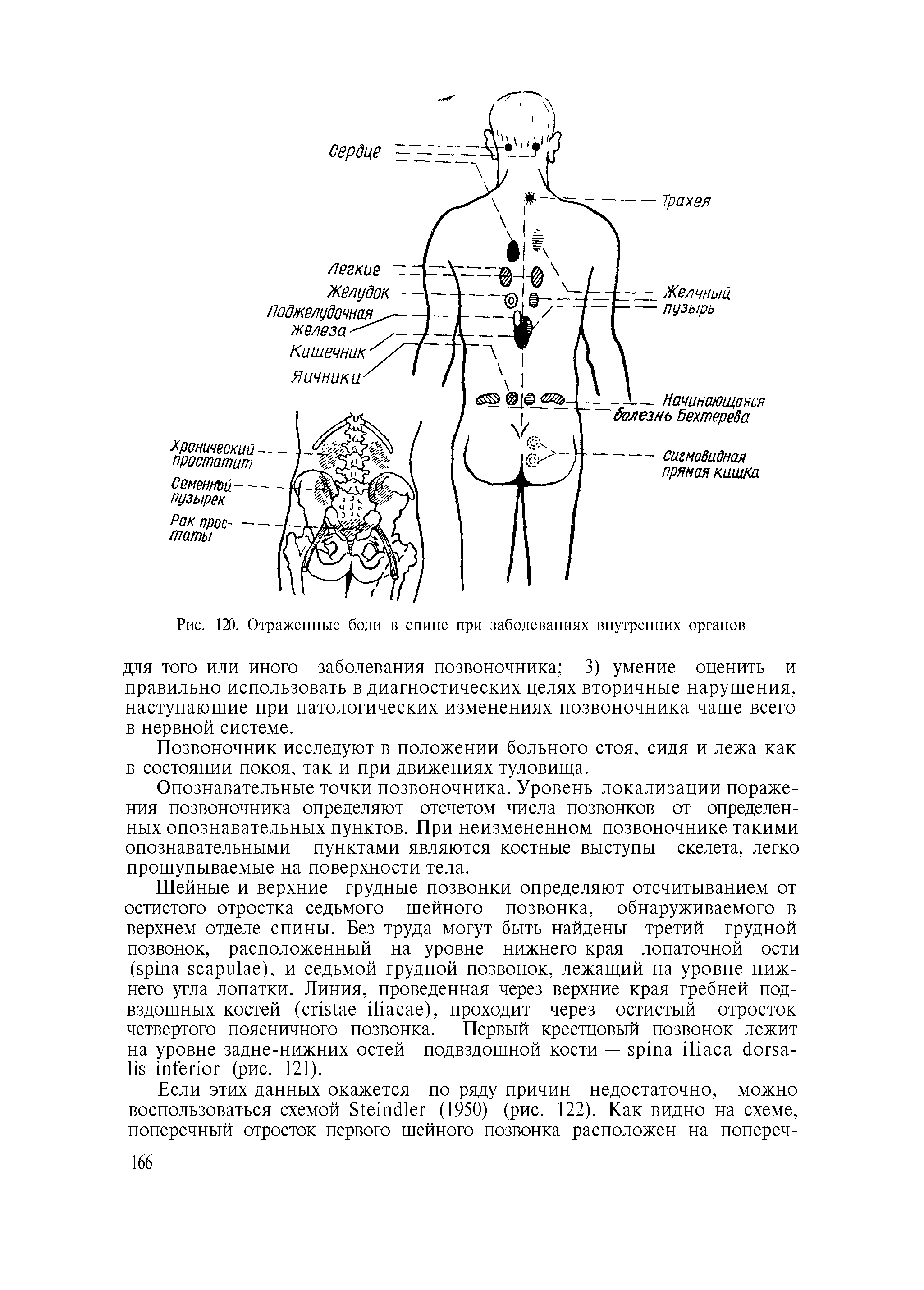 Рис. 120. Отраженные боли в спине при заболеваниях внутренних органов...