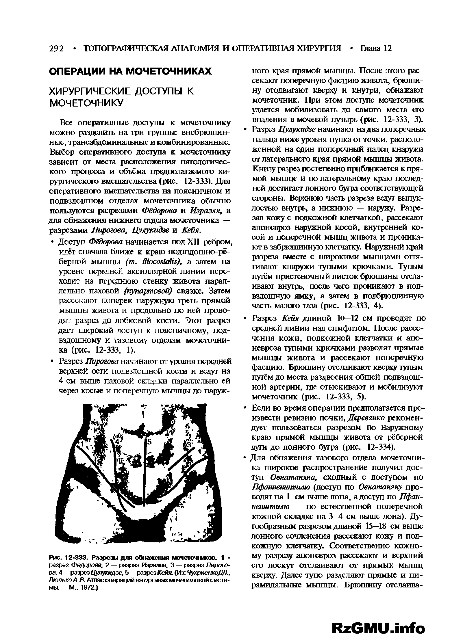 Рис. 12-333. Разрезы для обнажения мочеточмков. 1 -разрез Федорова, 2 — разраз Израэля, 3 — разрез Пирогова, 4 — разрез Цулукидзе, 5—разрез Кейя. (Из ЧухриегкоДЛ., Люлько А. В. Атлас операций на органах мочеполовой системы. - М.. 1972.)...