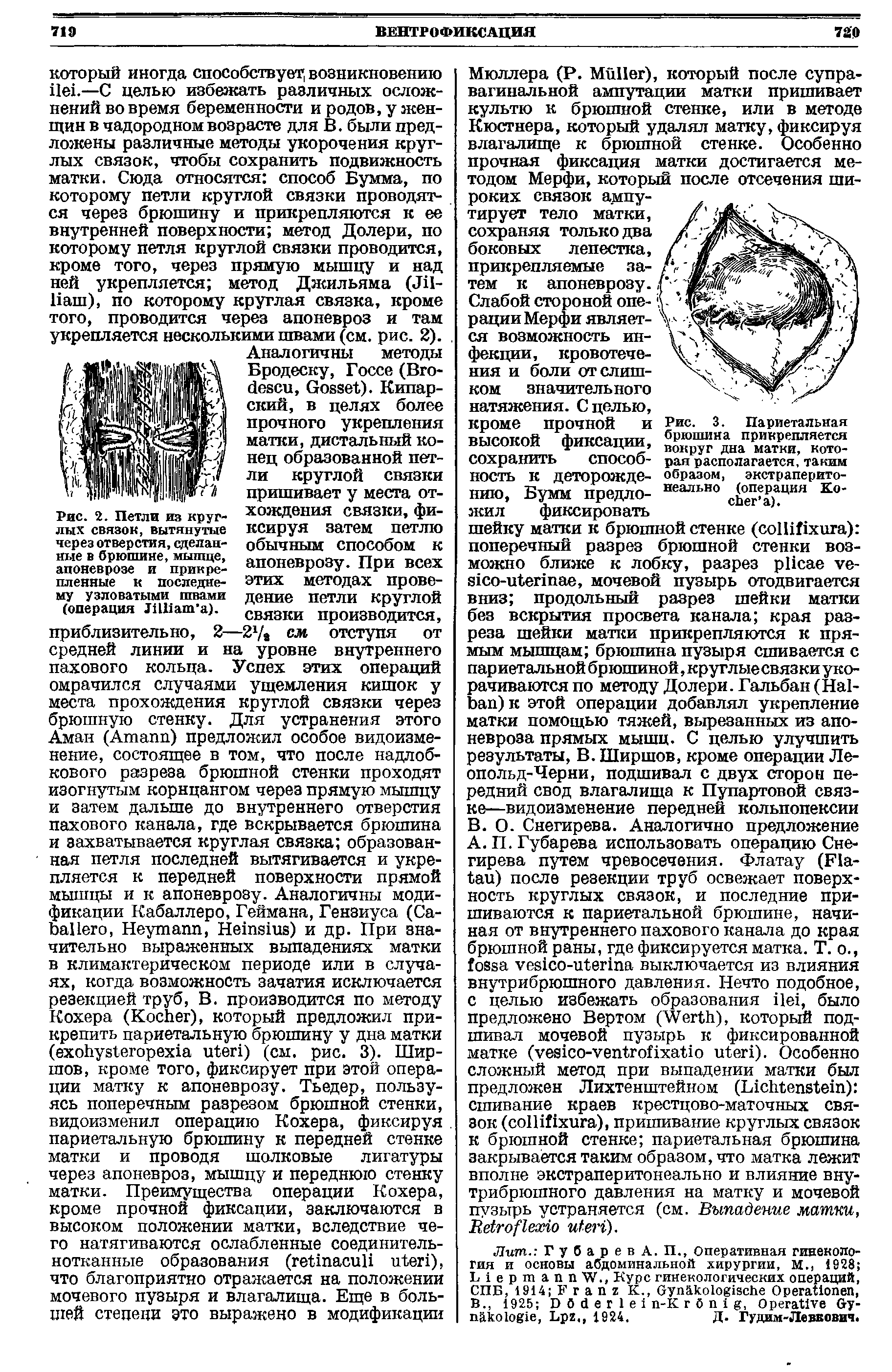 Рис. 2. Петли та круглых связок, вытянутые через отверстия, сделанные в брюшине, мышце, апоневрозе и прикрепленные к последнему узловатыми швами (операция ЛШат а).