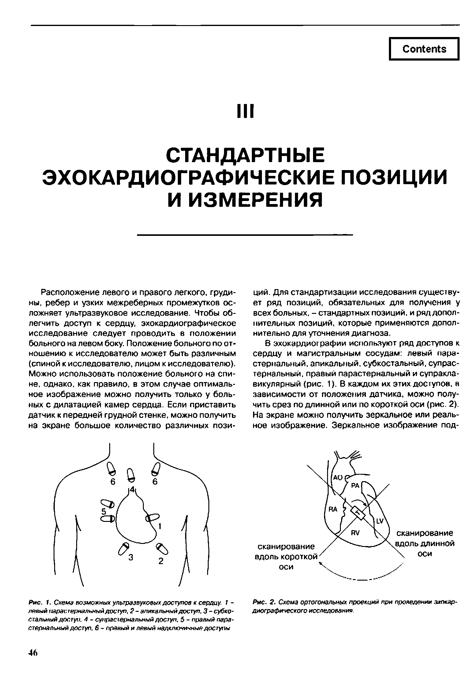 Рис. 1. Схема возможных ультразвуковых доступов к сердцу. 1 -левый парастернальный доступ. 2 - апикальный доступ, 3 - субкр-стальный доступ. 4 - сунрастернальный доступ. 5 - правый парастернальный доступ, 6 - правый и левый надключичные доступы...