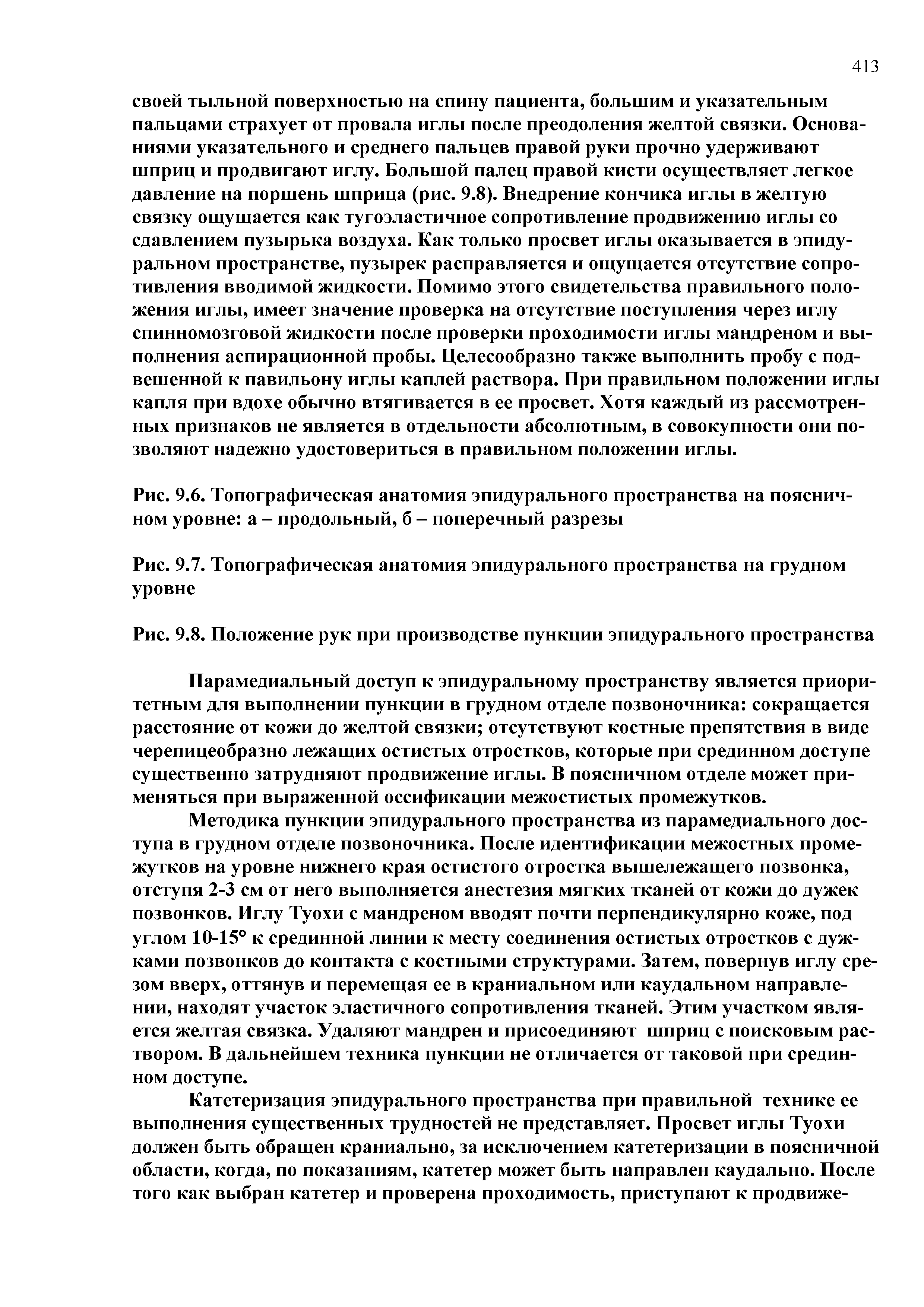 Рис. 9.6. Топографическая анатомия эпидурального пространства на поясничном уровне а - продольный, б - поперечный разрезы...