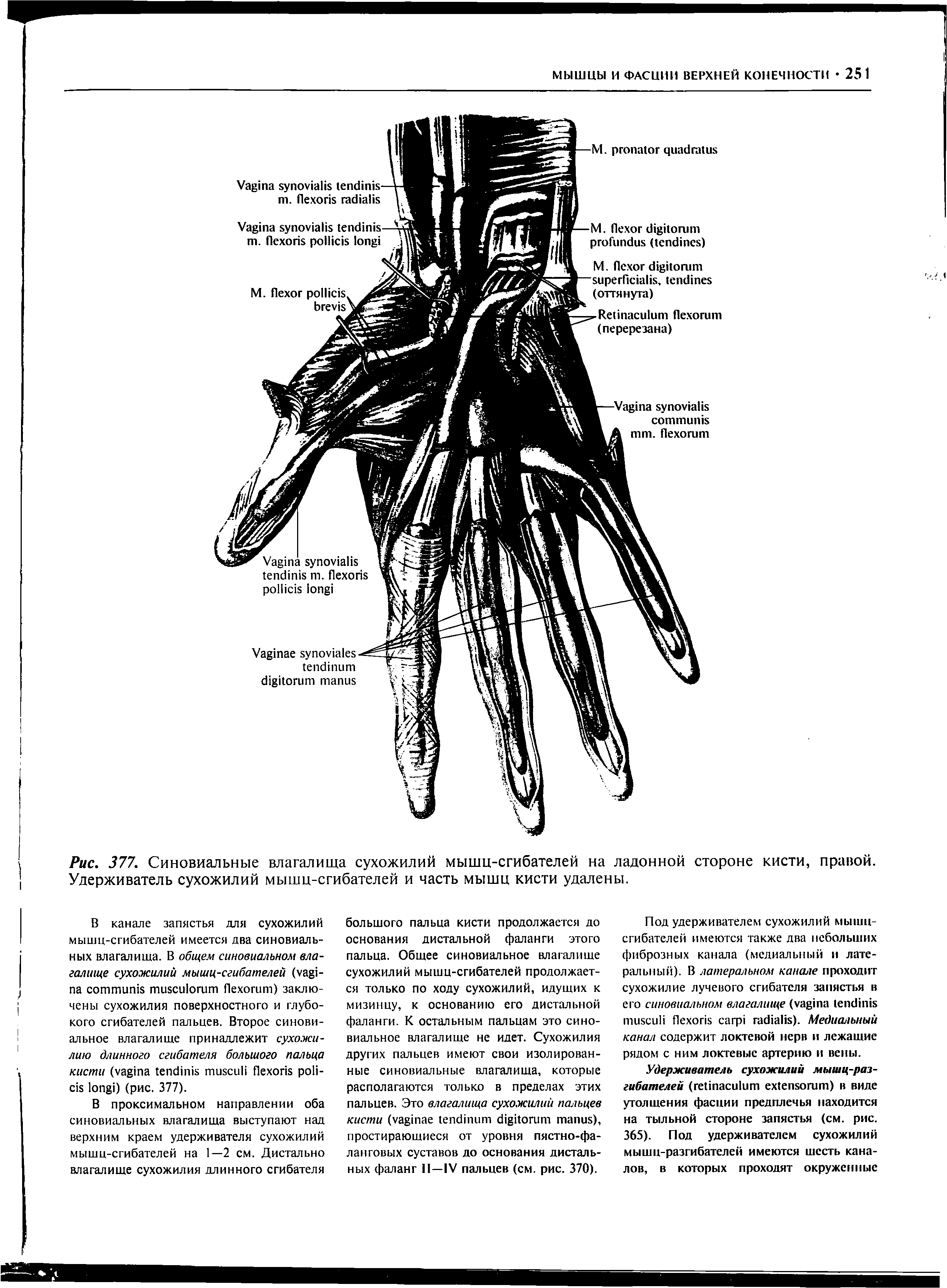 Рис. 377. Синовиальные влагалища сухожилий мышц-сгибателей на ладонной стороне кисти, правой. Удерживатель сухожилий мышц-сгибателей и часть мышц кисти удалены.