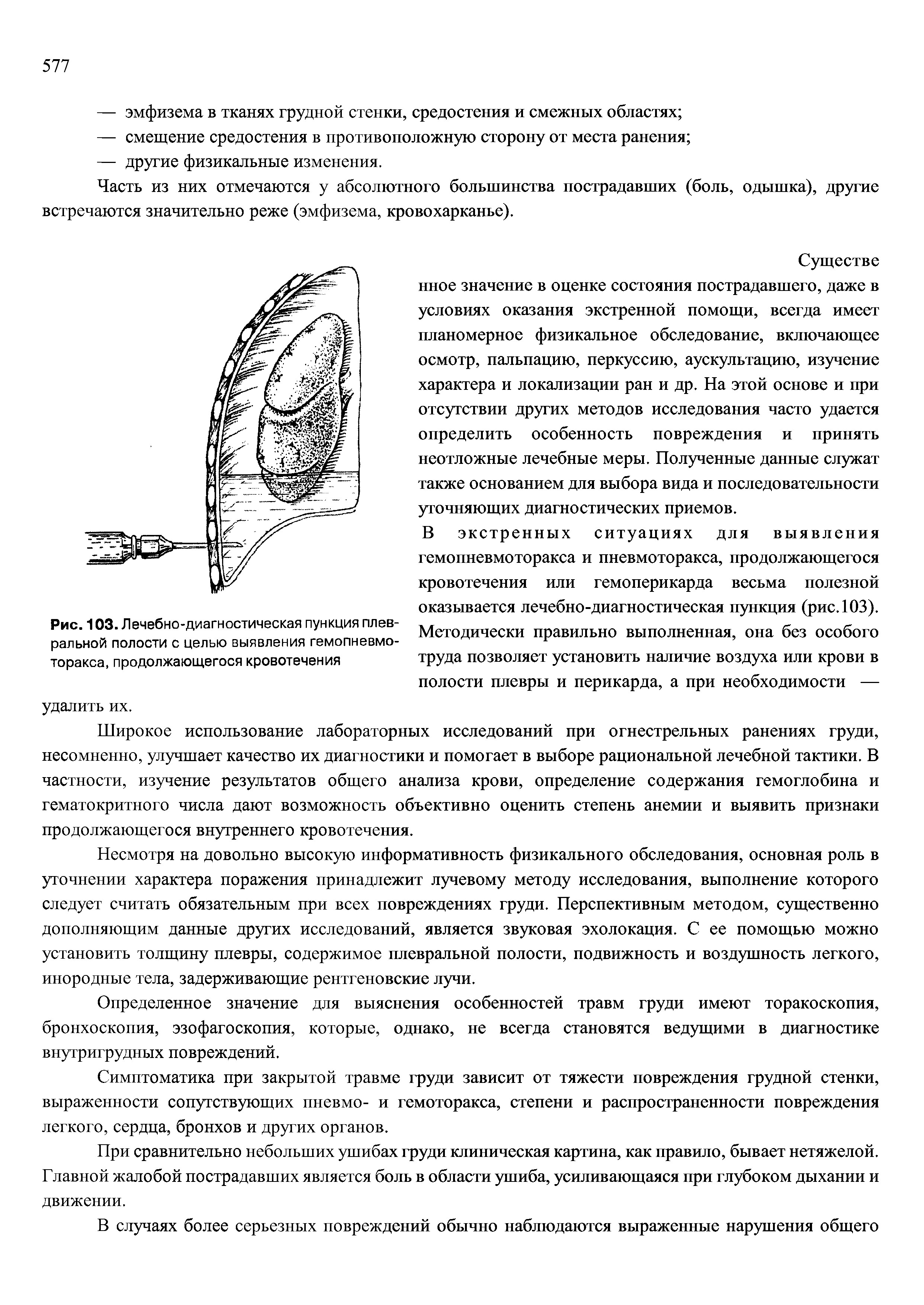Рис. 103. Лечебно-диагностическая пункция плевральной полости с целью выявления гемопневмоторакса, продолжающегося кровотечения...