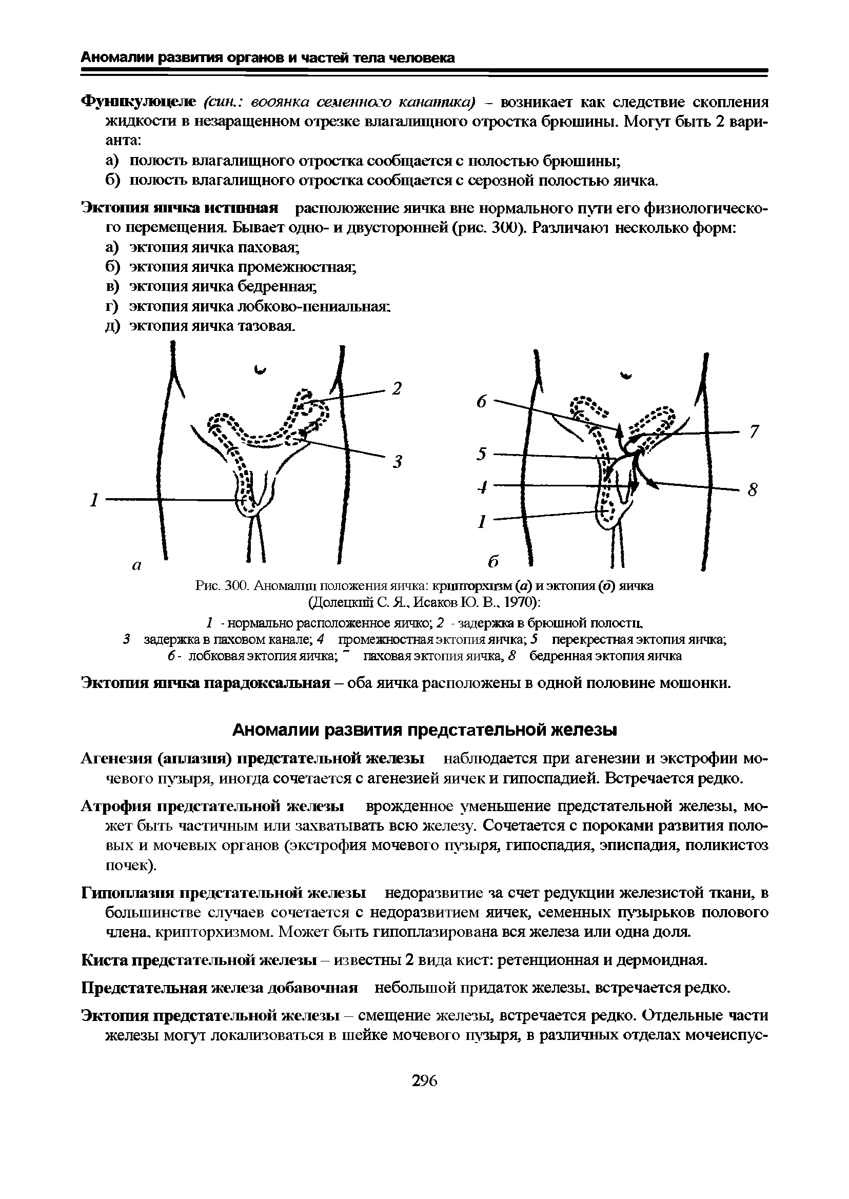 Рис. 300. Аномалии положения яичка крипторхизм (а) и эктопия (о) яичка (Долецкпп С. Я., Исаков Ю. В.. 1970) ...