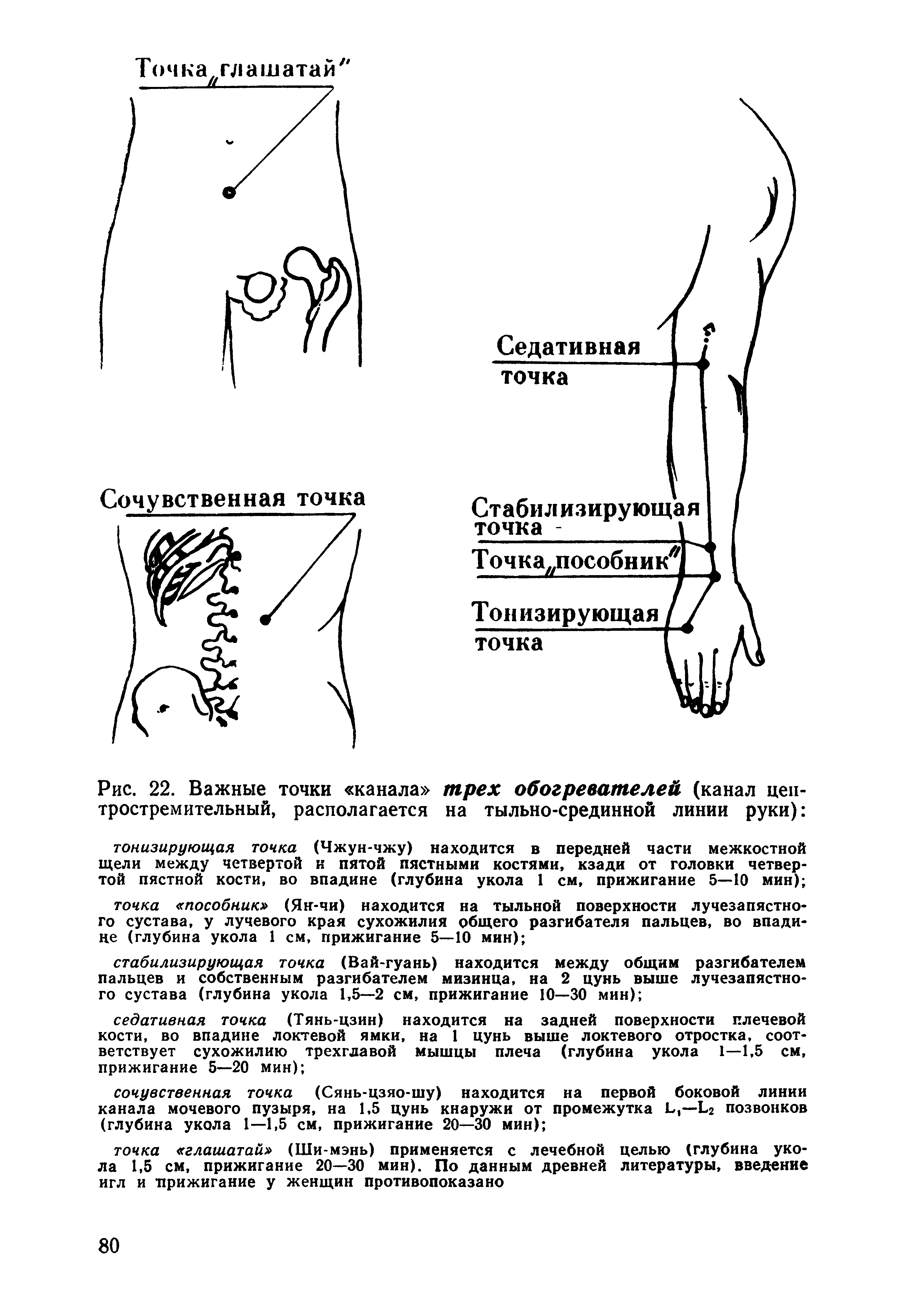 Рис. 22. Важные точки канала трех обогревателей (канал центростремительный, располагается на тыльно-срединной линии руки) ...