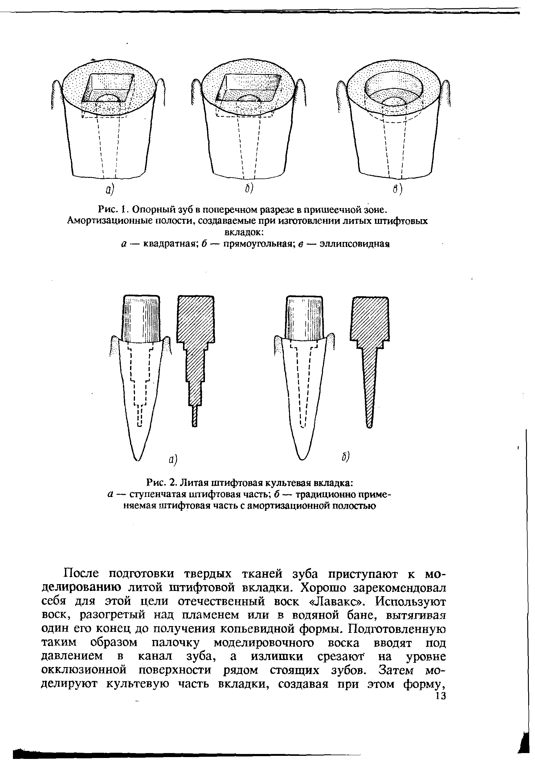 Рис. 2. Литая штифтовая культевая вкладка а — ступенчатая штифтовая часть б — традиционно применяемая штифтовая часть с амортизационной полостью...