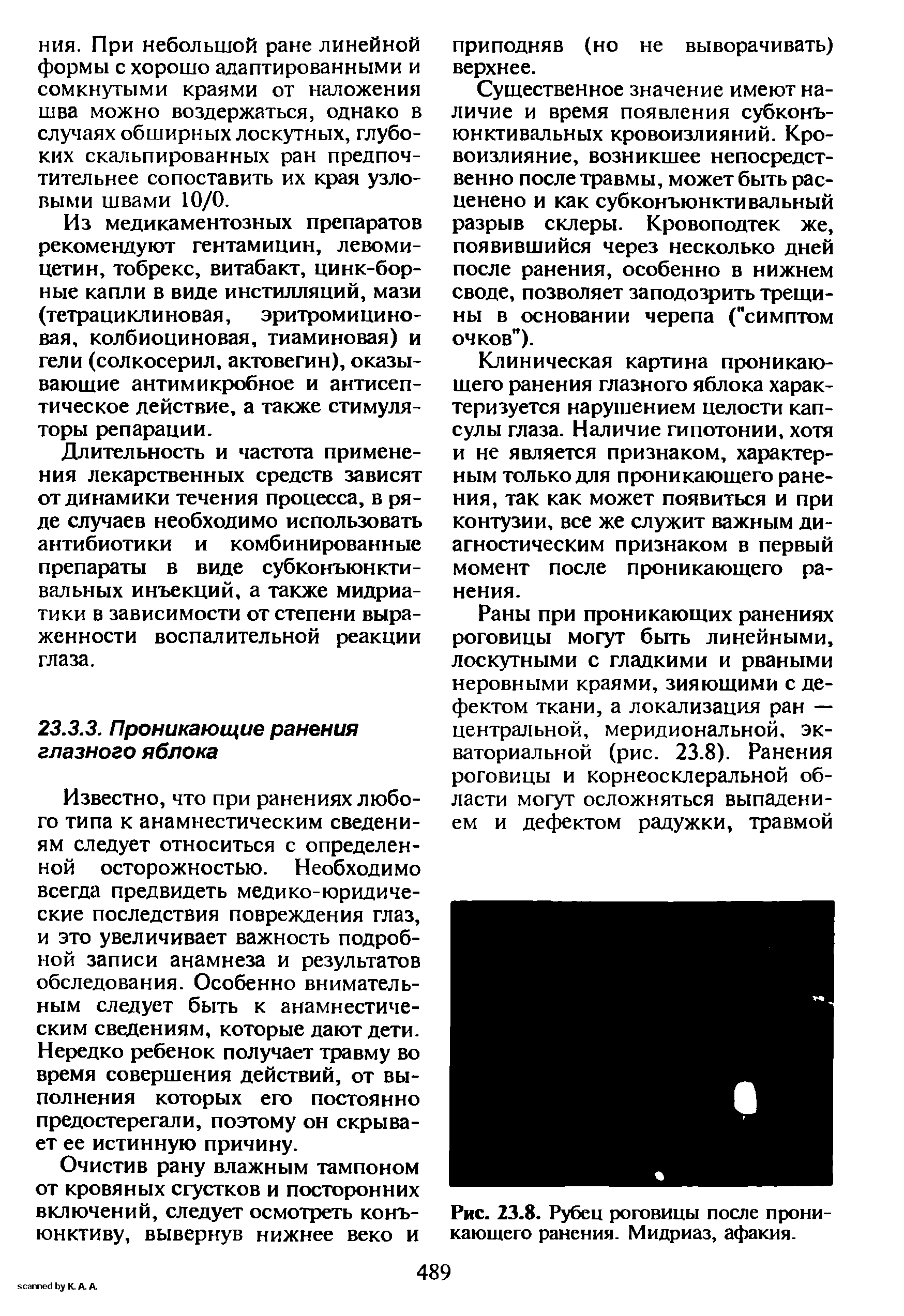 Рис. 23.8. Рубец роговицы после проникающего ранения. Мидриаз, афакия.