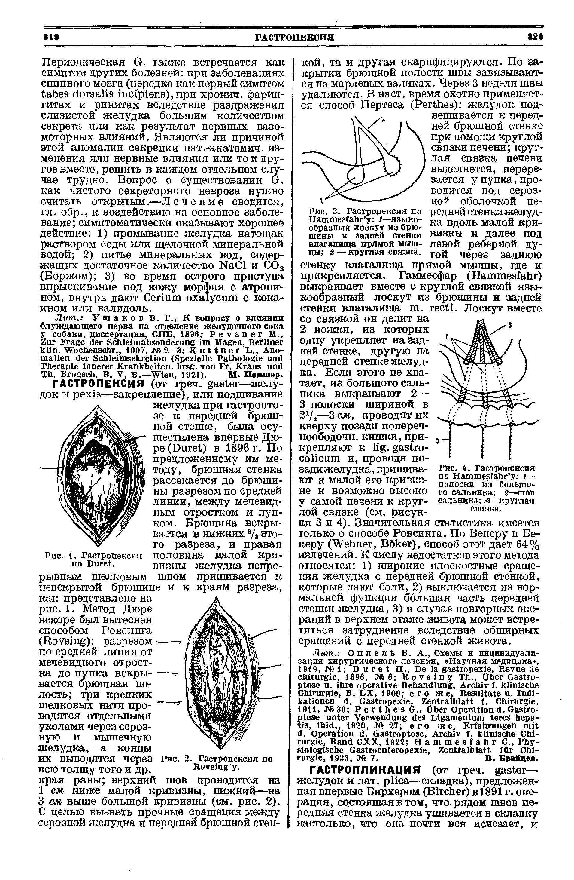 Рис. 3. Гастропексия по Наттей аЬг у 1—языкообразный лоскут из брюшины и задней стенки влагалища прямой мышцы 2 — круглая связка.