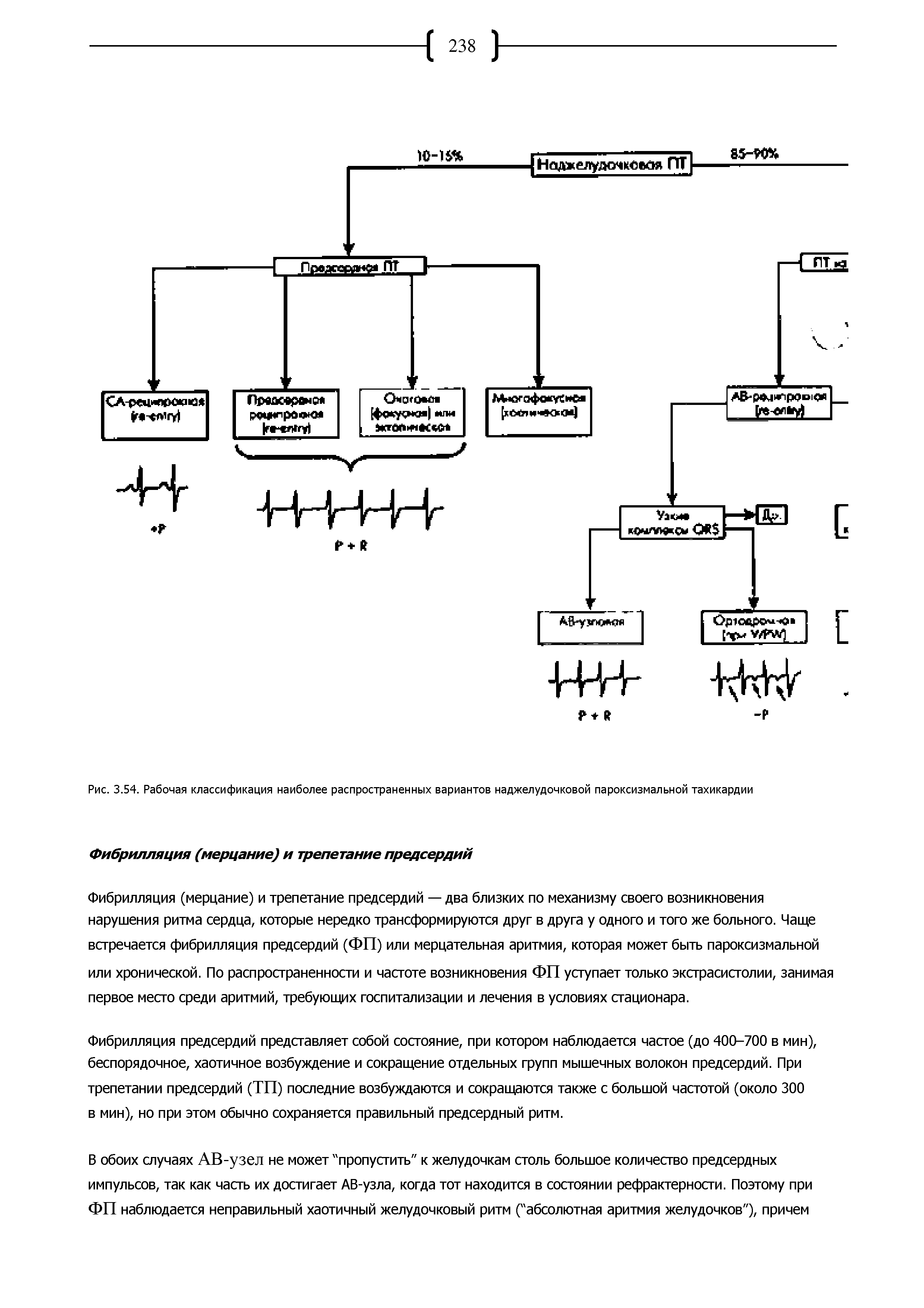Рис. 3.54. Рабочая классификация наиболее распространенных вариантов наджелудочковой пароксизмальной тахикардии...