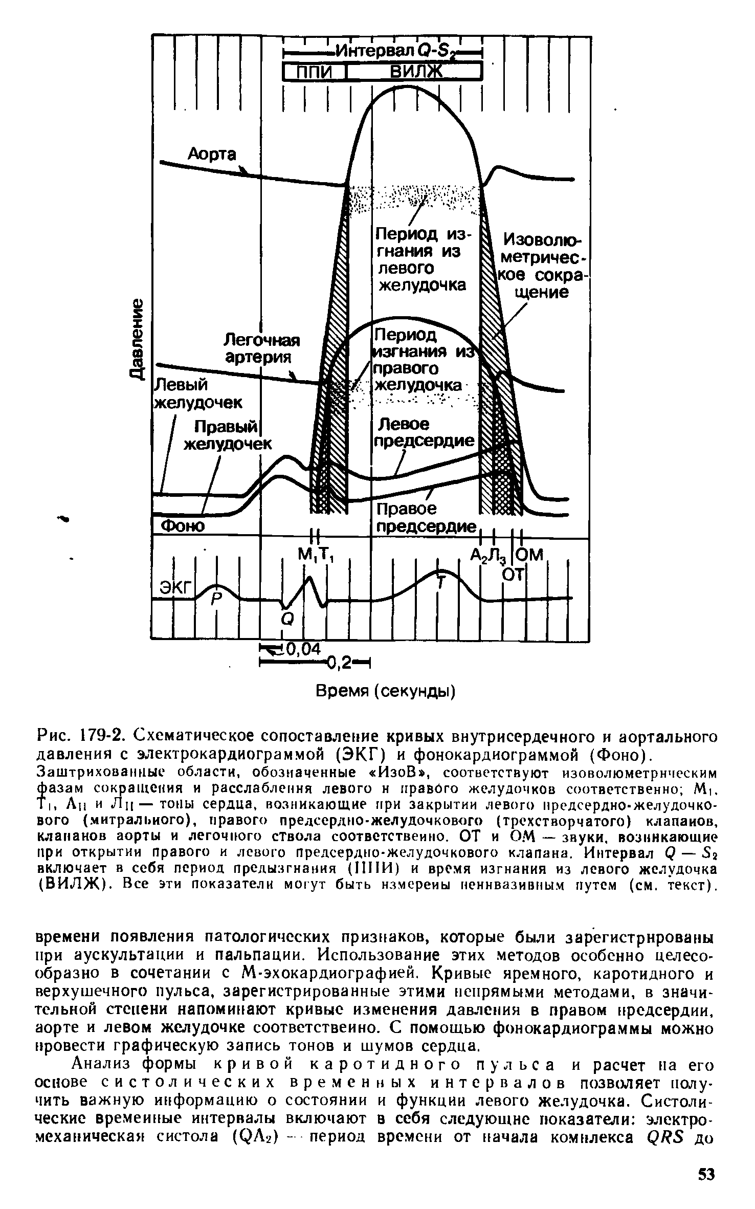 Рис. 179-2. Схематическое сопоставление кривых внутрисердечного и аортального давления с электрокардиограммой (ЭКГ) и фонокардиограммой (Фоно). Заштрихованные области, обозначенные ИзоВ , соответствуют изоволюметрнческим азам сокращения и расслабления левого н правого желудочков соответственно М,.