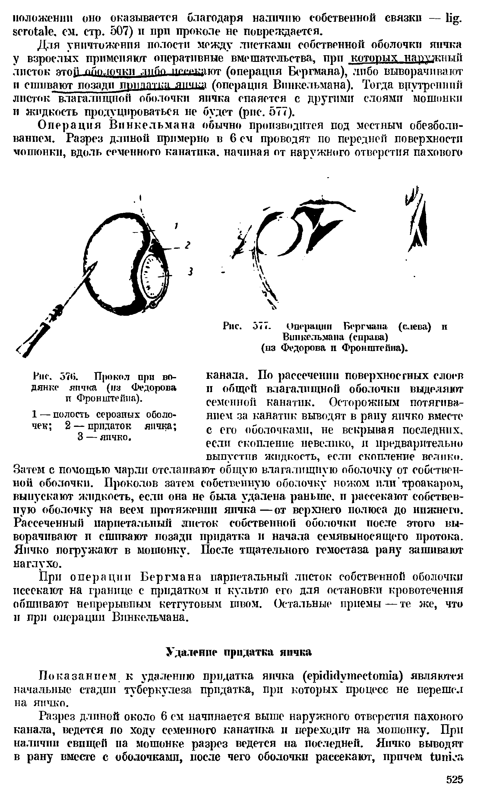 Рис. 577. Операции Бергмана (слева) и Винкельмана (справа) (пз Федорова и Фронштеппа).