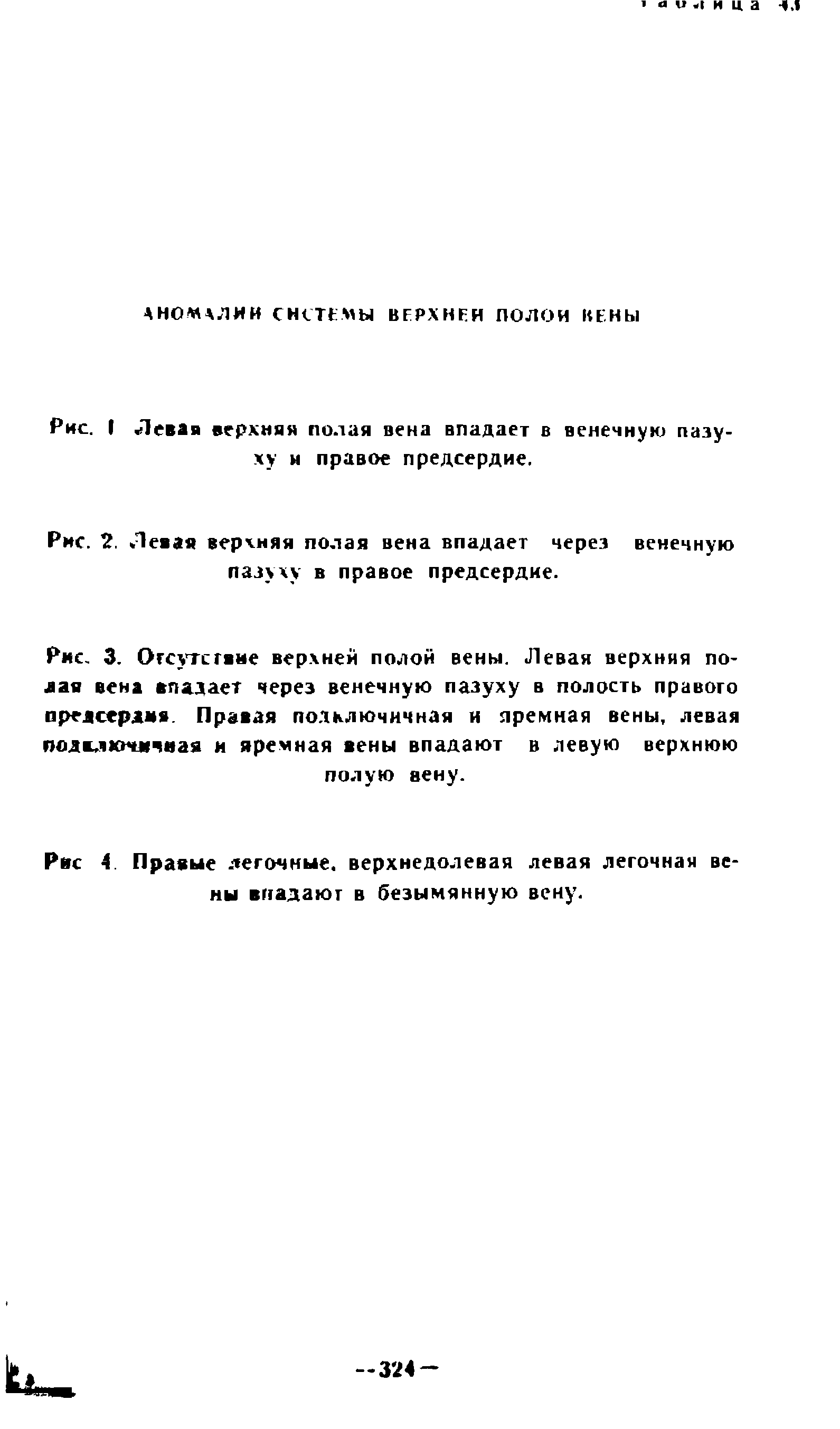 Рис. 2. Левая верхняя полая вена впадает через венечную пазуху в правое предсердие.