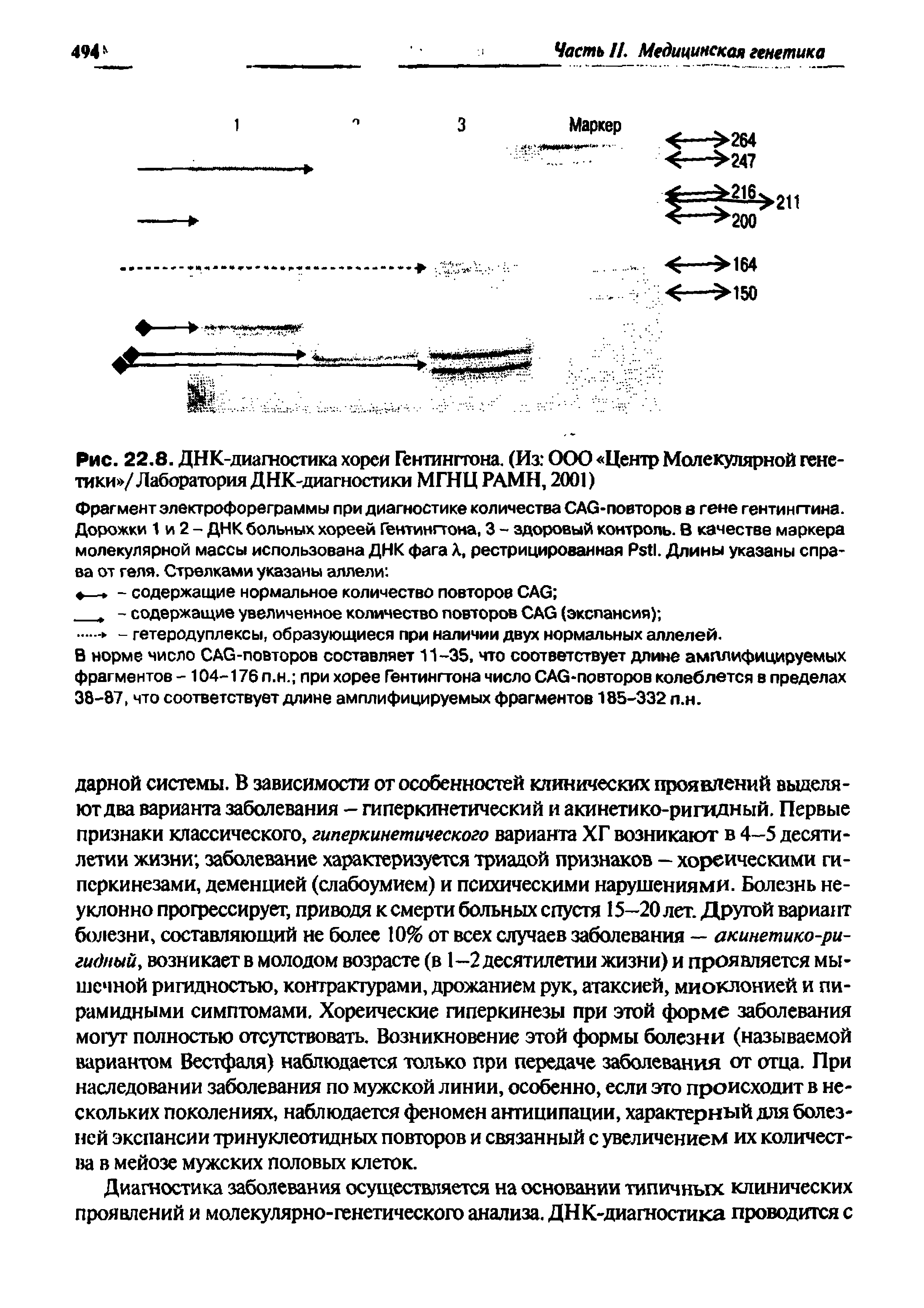 Рис. 22.8. ДНК-диагностика хореи Гентингтона. (Из ООО Центр Молекулярной генетики /Лаборатория ДНК-диагностики МГНЦ РАМН, 2001)...