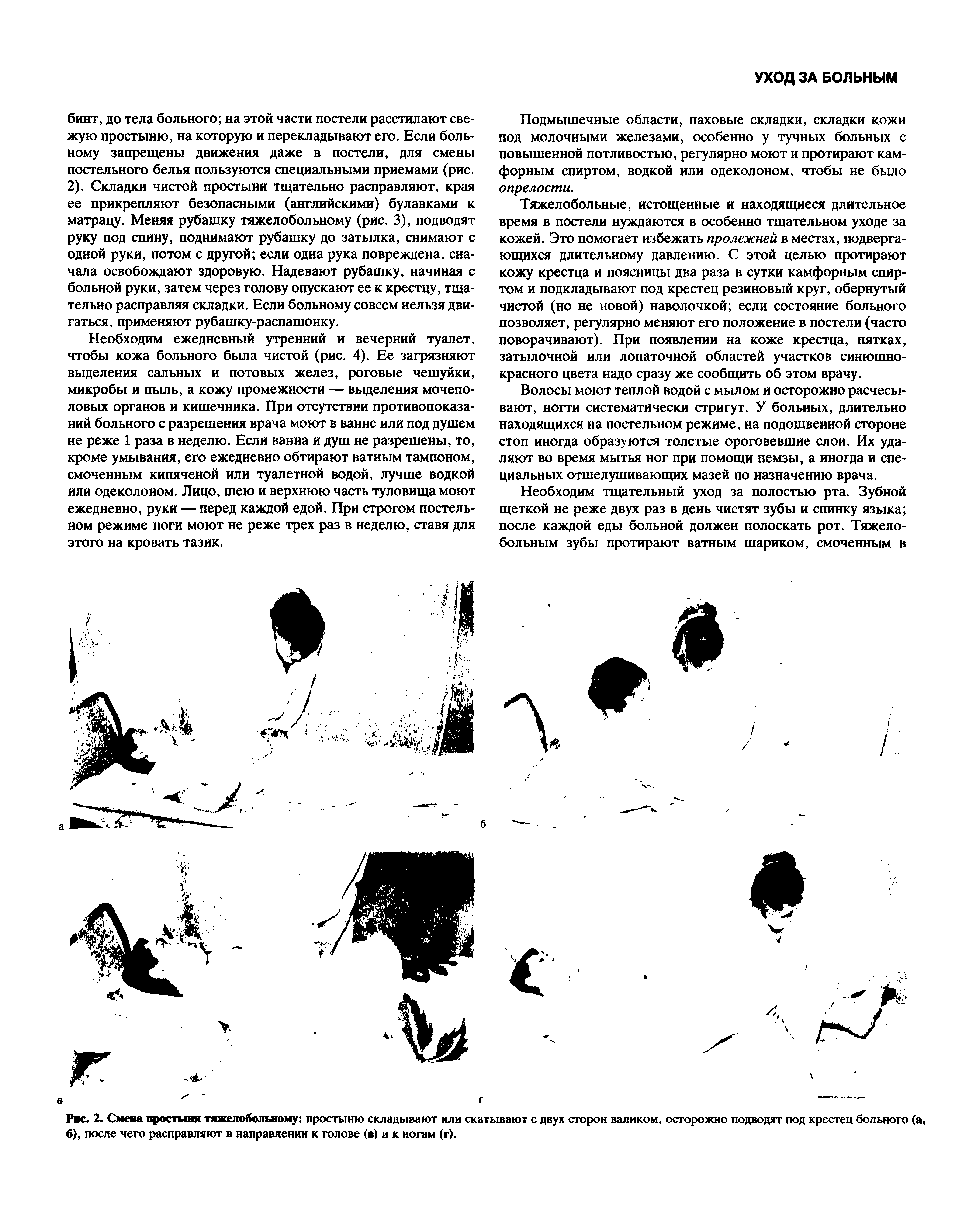 Рис. 2. Смена простыни тяжелобольному простыню складывают или скатывают с двух сторон валиком, осторожно подводят под крестец больного (а, б), после чего расправляют в направлении к голове (в) и к ногам (г).