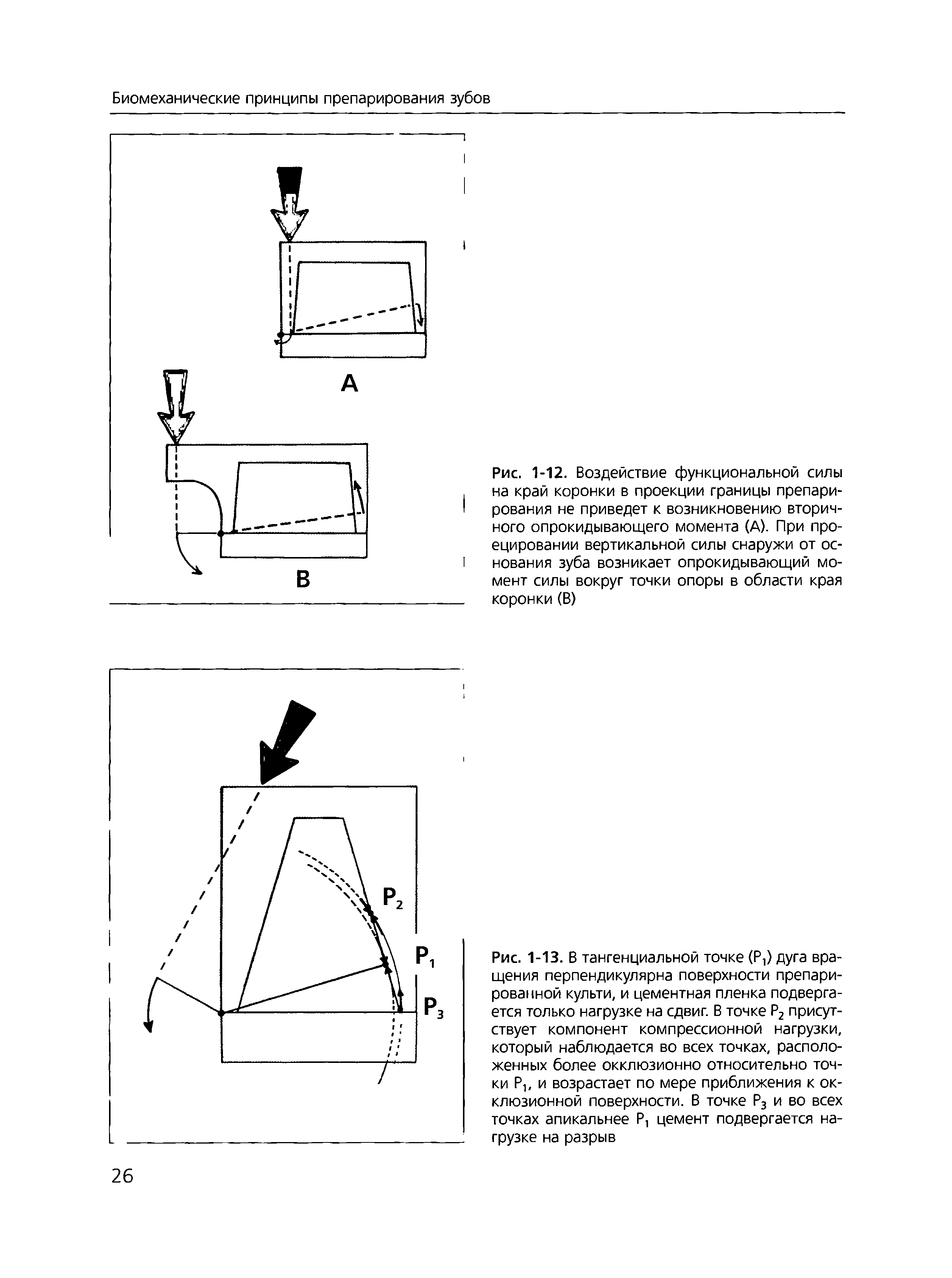 Рис. 1-12. Воздействие функциональной силы на край коронки в проекции границы препарирования не приведет к возникновению вторичного опрокидывающего момента (А). При проецировании вертикальной силы снаружи от основания зуба возникает опрокидывающий момент силы вокруг точки опоры в области края коронки (В)...