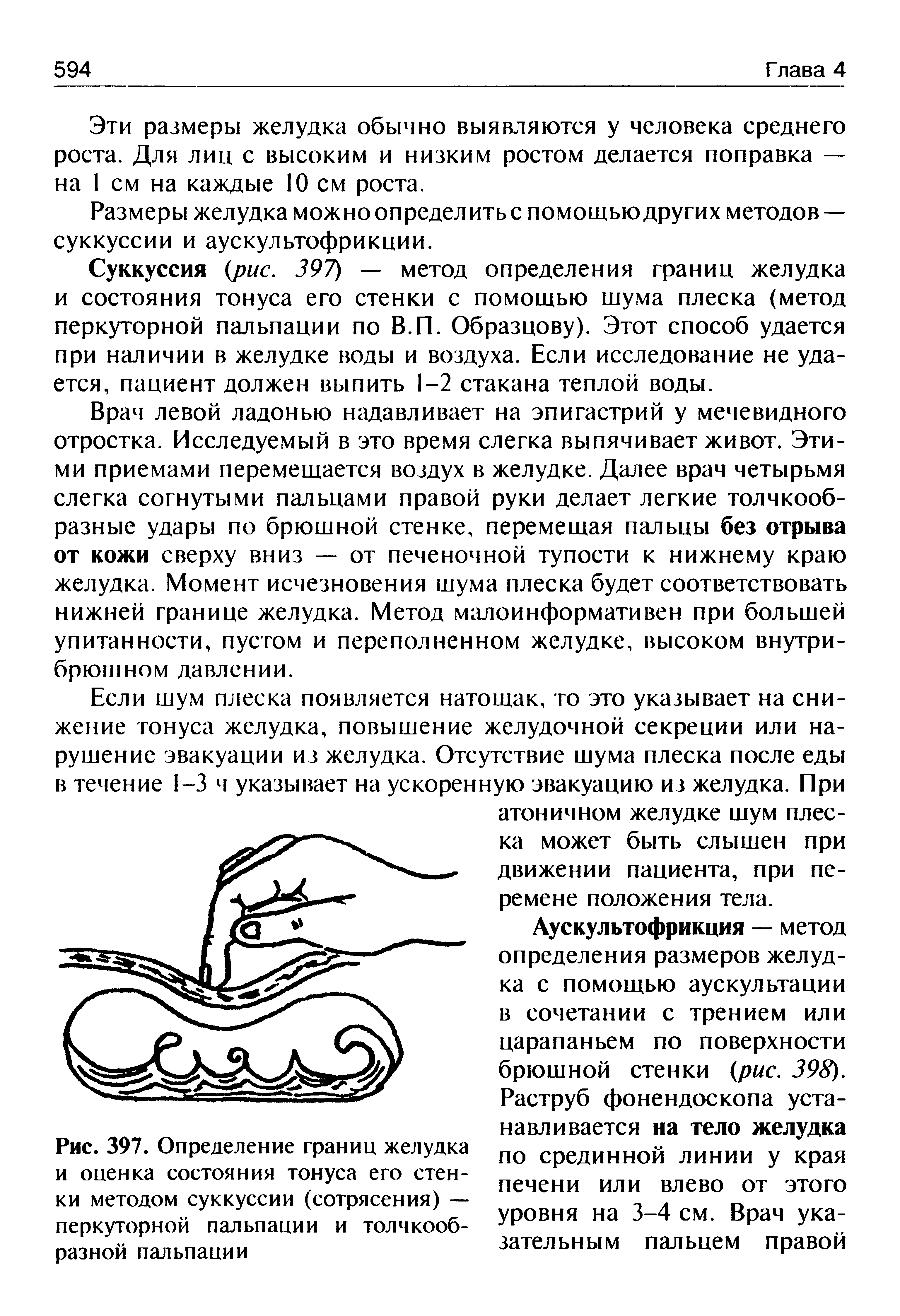 Рис. 397. Определение границ желудка и оценка состояния тонуса его стенки методом суккуссии (сотрясения) — перкуторной пальпации и толчкообразной пальпации...