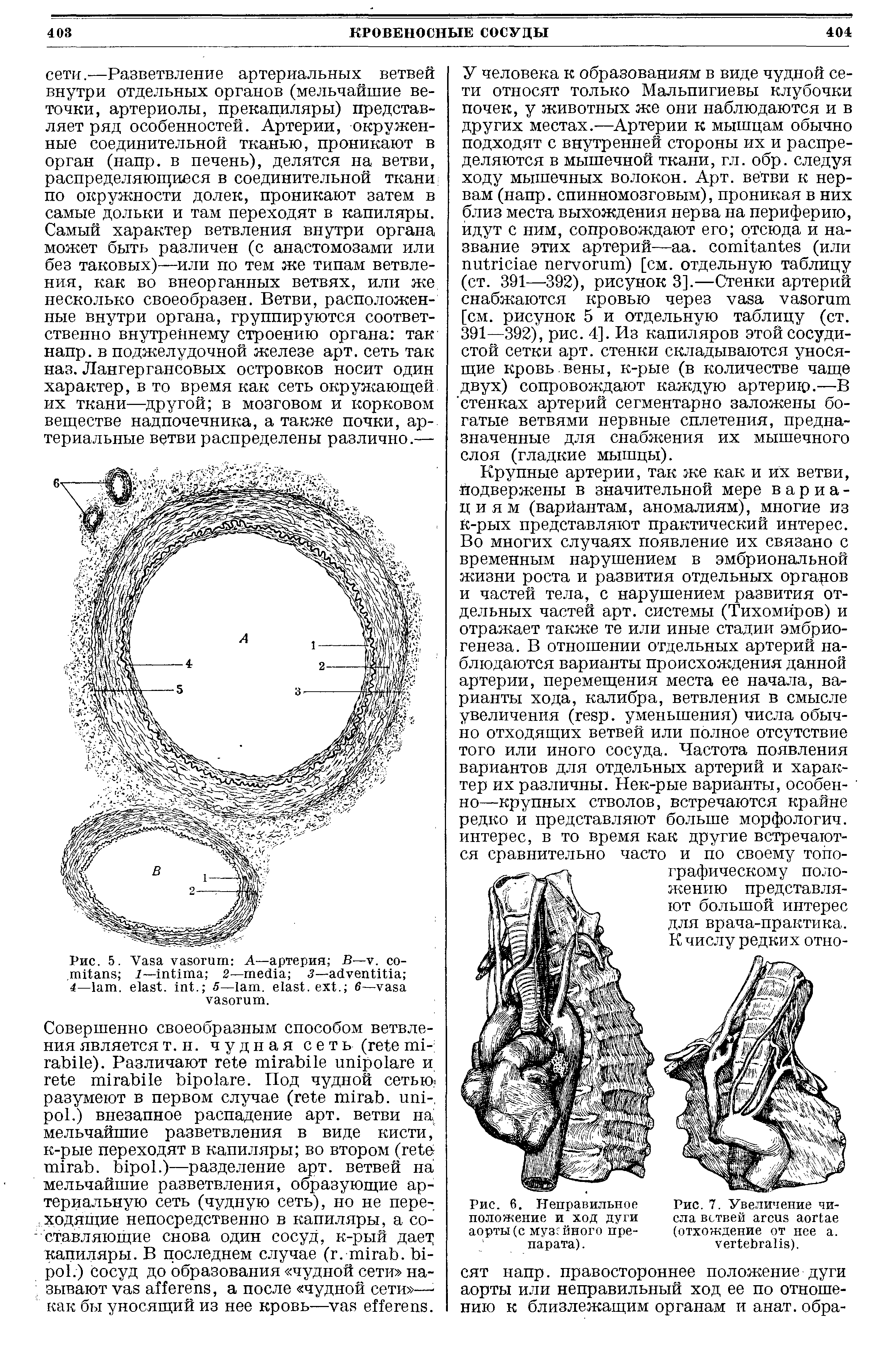 Рис. 6. Неправильное Рис. 7. Увеличение чи-положение и ход дуги ела ветвей аорты(с музгйного пре- (отхождение от нее а. парата). ).