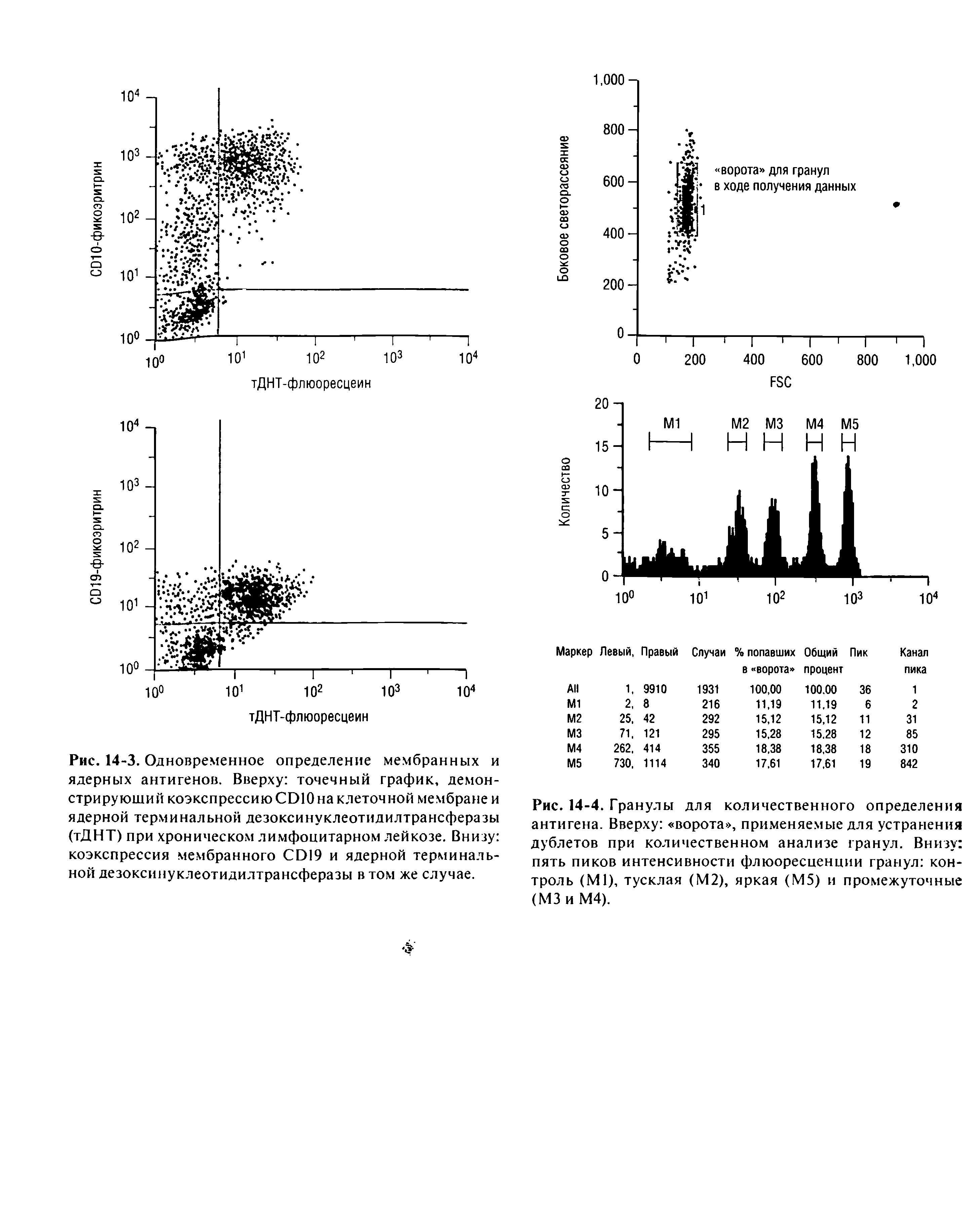 Рис. 14-3. Одновременное определение мембранных и ядерных антигенов. Вверху точечный график, демонстрирующий коэкспрессию СЭЮ на клеточной мембране и ядерной терминальной дезоксинуклеотидилтрансферазы (тДНТ) при хроническом лимфоцитарном лейкозе. Внизу коэкспрессия мембранного СЫ9 и ядерной терминальной дезоксинуклеотидилтрансферазы в том же случае.