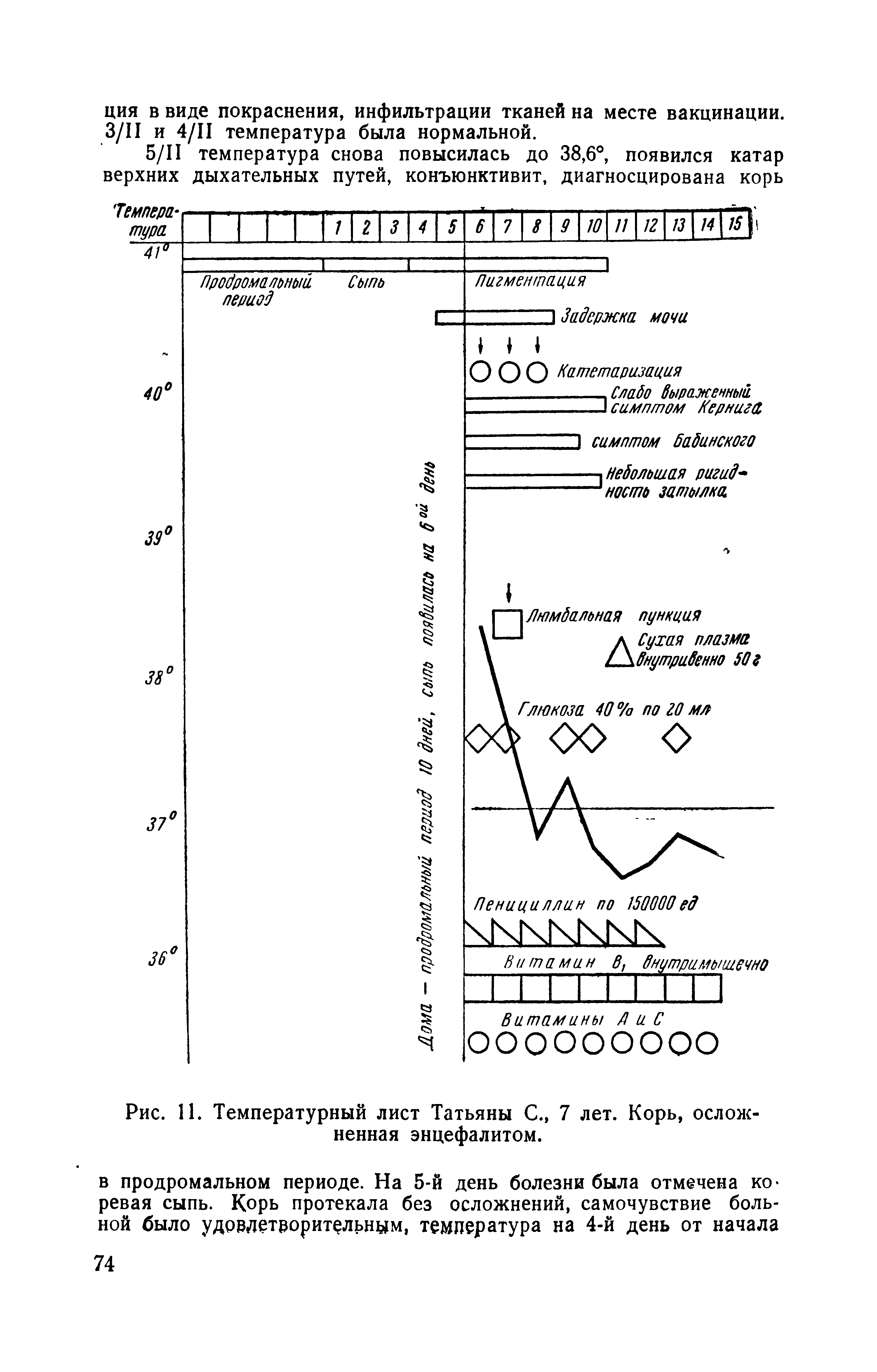 Рис. 11. Температурный лист Татьяны С., 7 лет. Корь, осложненная энцефалитом.