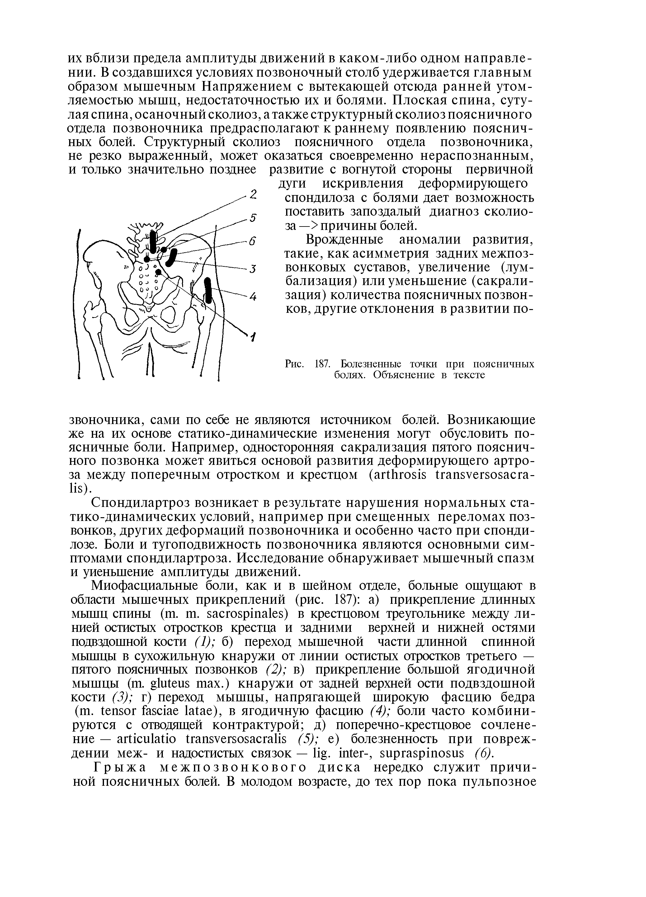 Рис. 187. Болезненные точки при поясничных болях. Объяснение в тексте...