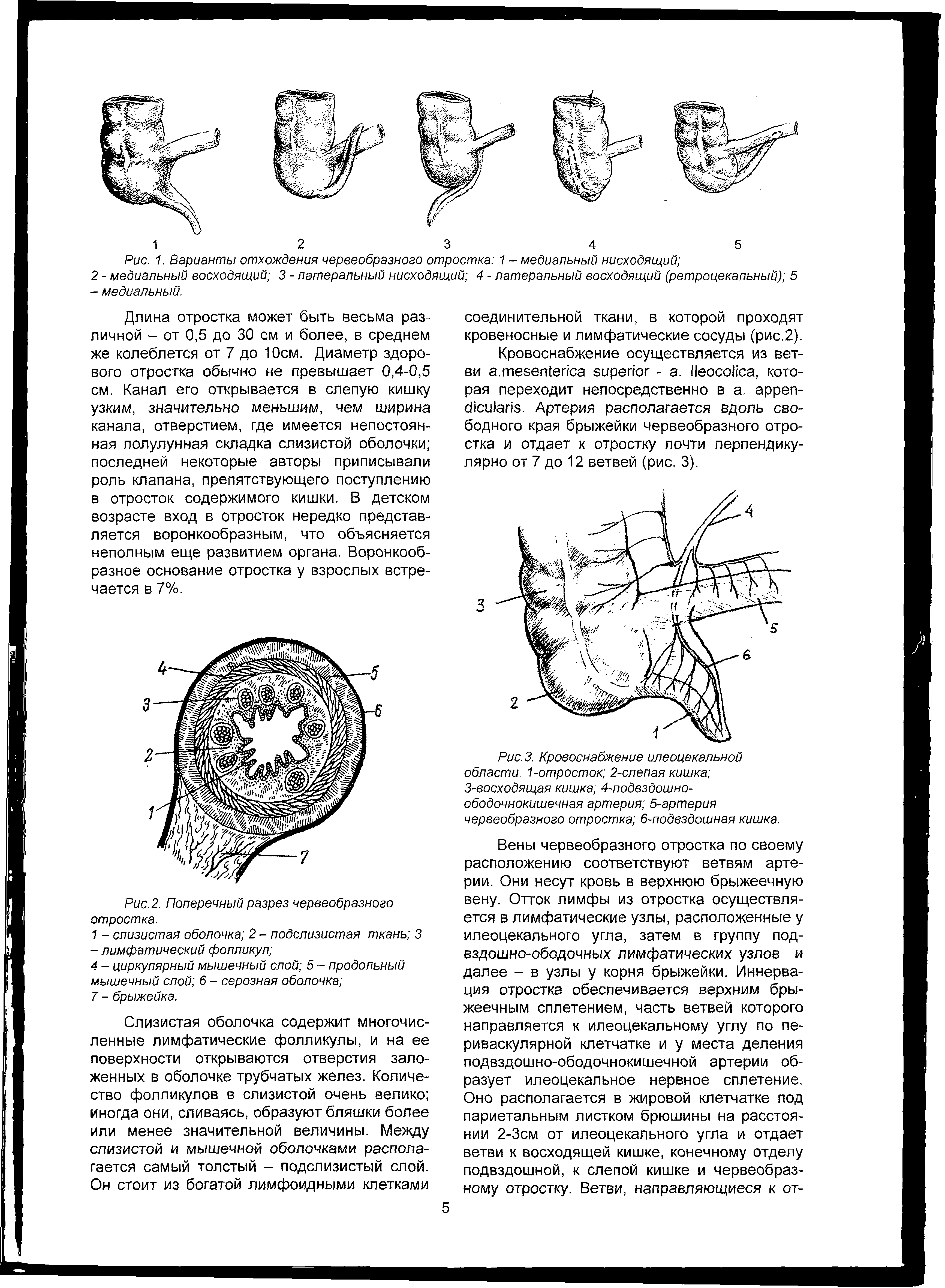 Рис. 3. Кровоснабжение илеоцекальной области. 1-отросток 2-слепая кишка 3-восходящая кишка 4-подвздошно-ободочнокишечная артерия 5-артерия червеобразного отростка 6-подвздошная кишка.