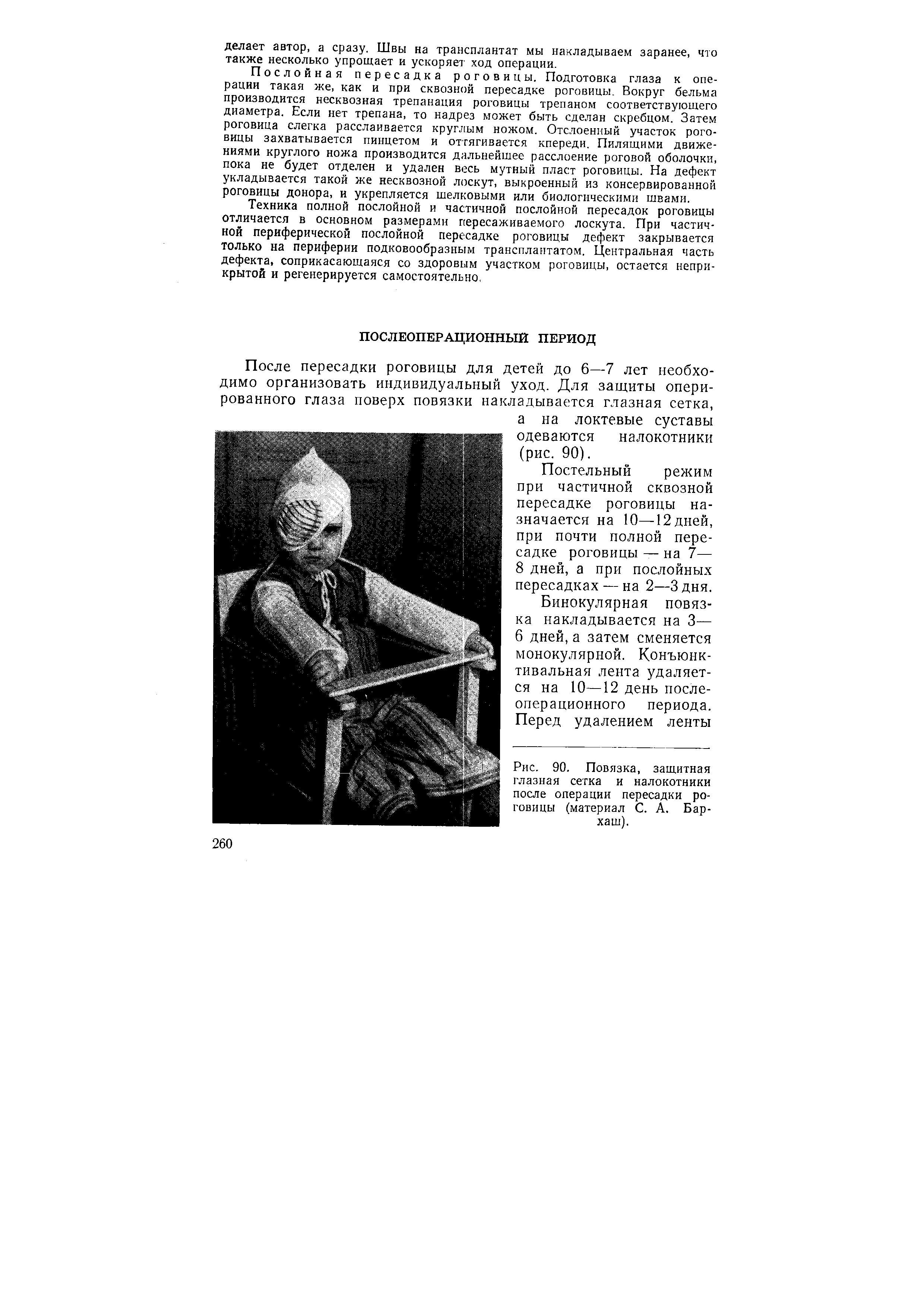 Рис. 90. Повязка, защитная глазная сетка и налокотники после операции пересадки роговицы (материал С. А. Бар-хаш).