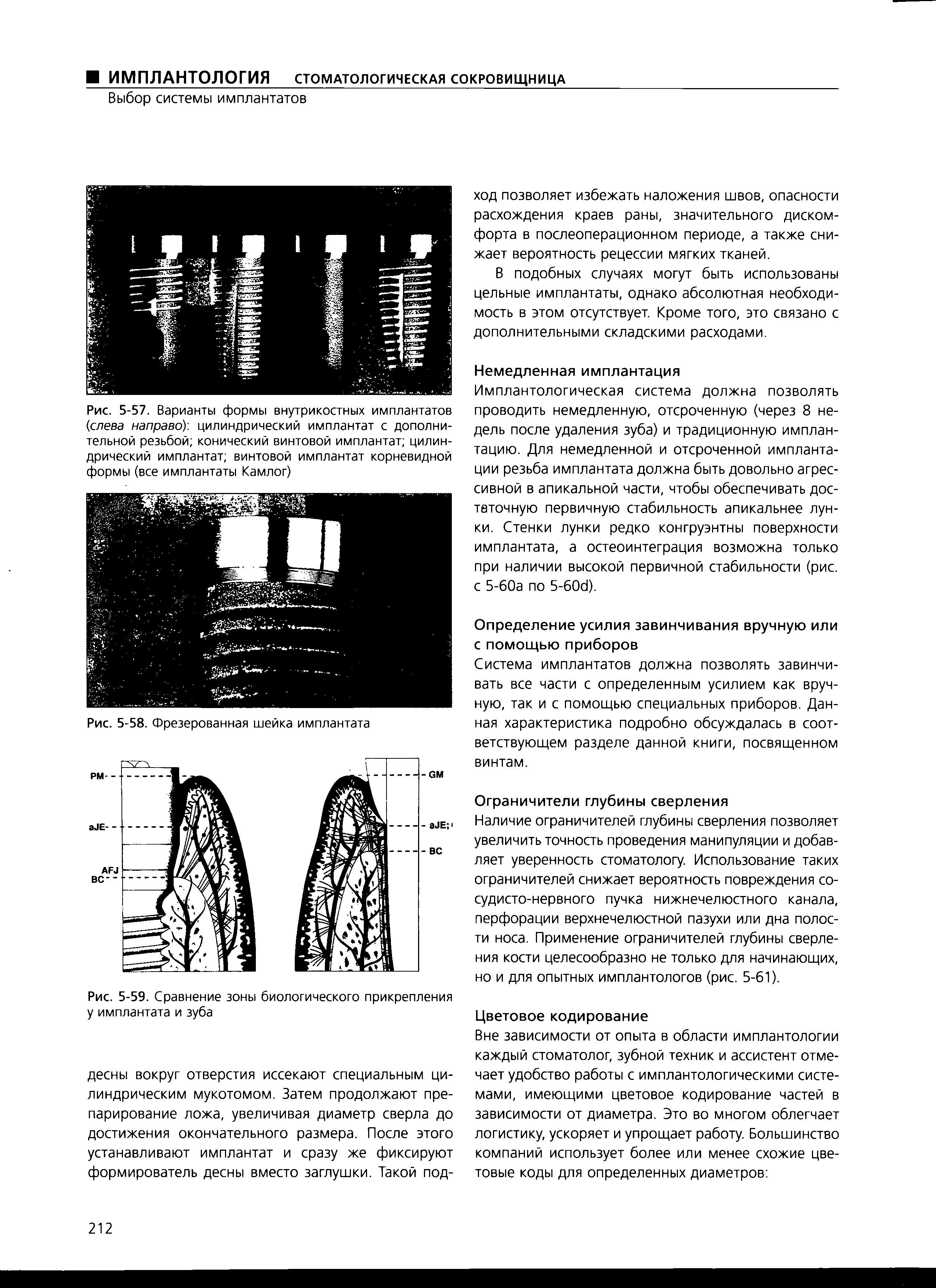 Рис. 5-57. Варианты формы внутрикостных имплантатов (слева направо), цилиндрический имплантат с дополнительной резьбой конический винтовой имплантат цилиндрический имплантат винтовой имплантат корневидной формы (все имплантаты Камлог)...