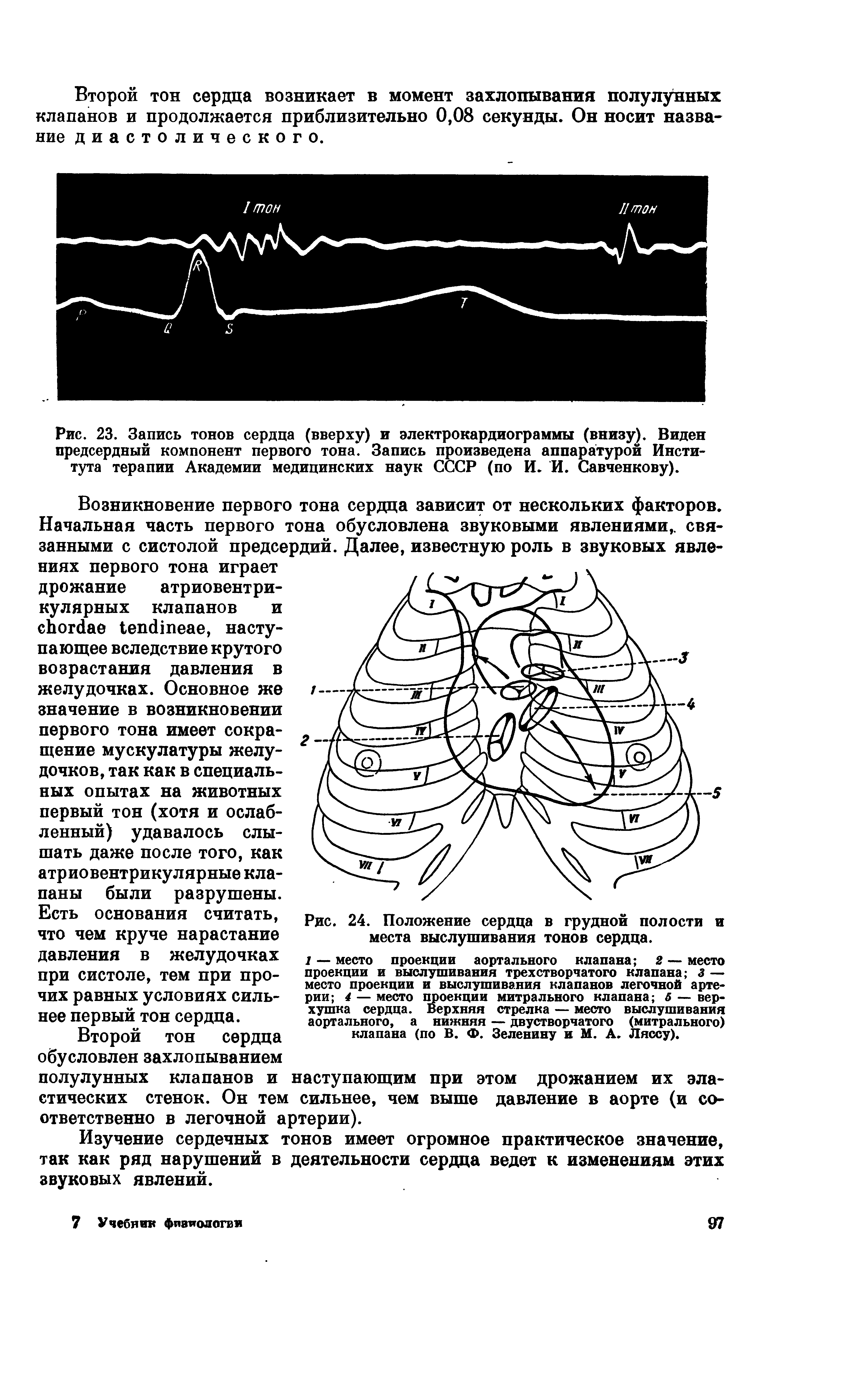 Рис. 23. Запись тонов сердца (вверху) и электрокардиограммы (внизу). Виден предсердный компонент первого тона. Запись произведена аппаратурой Института терапии Академии медицинских наук СССР (по И. И. Савченкову).