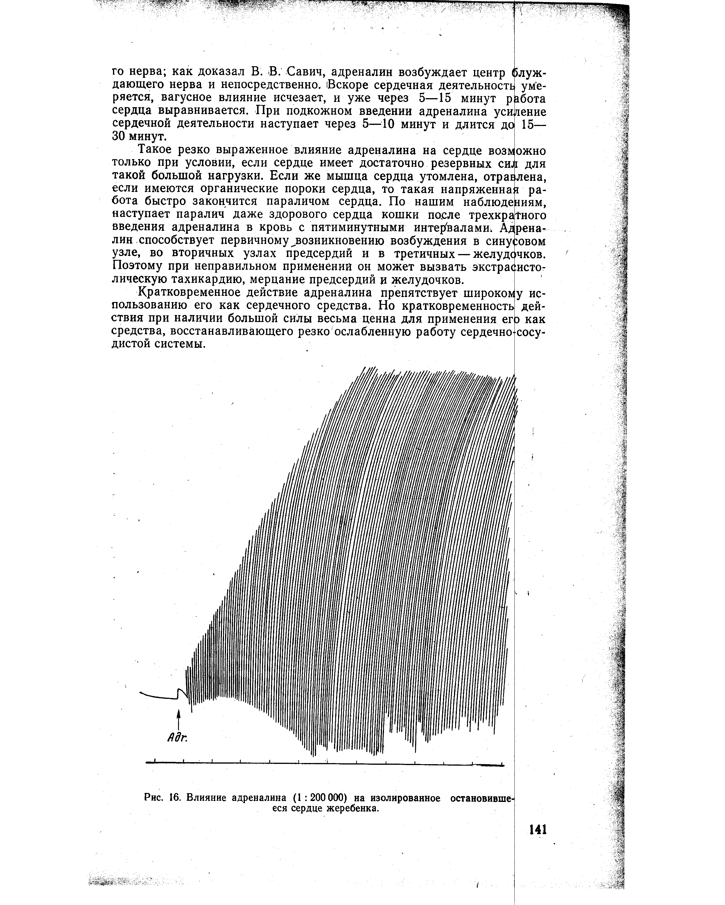 Рис. 16. Влияние адреналина (1 200 000) на изолированное остановившееся сердце жеребенка.