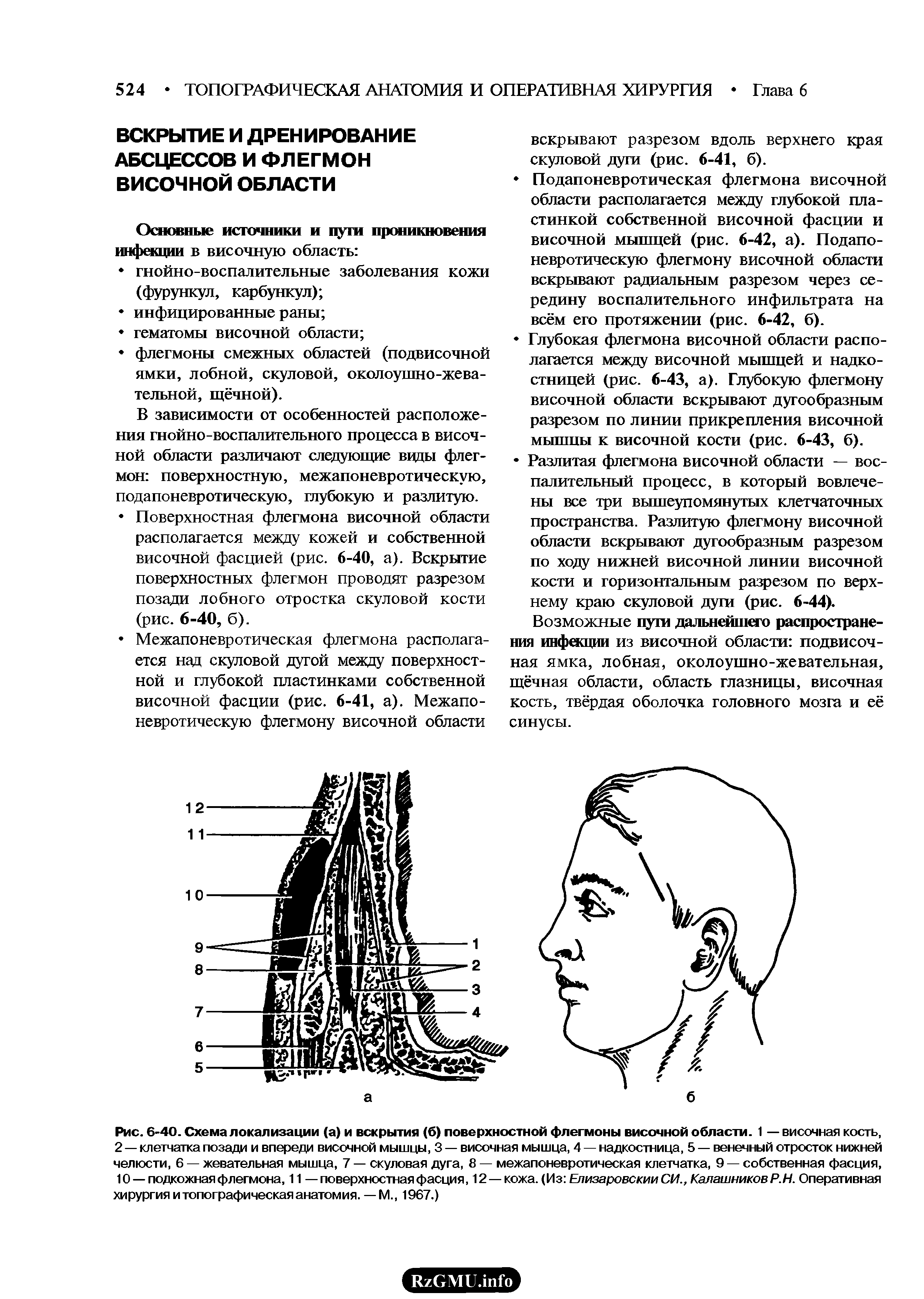 Рис. 6-40. Схема локализации (а) и вскрытия (б) поверхностной флегмоны височной области. 1 — височная кость, 2 — клетчатка позади и впереди височной мышцы, 3 — височная мышца, 4 — надкостница, 5 — венечный отросток нижней челюсти, 6 — жевательная мышца, 7 — скуловая дуга, 8 — межапоневротическая клетчатка, 9 — собственная фасция, 10 —подкожная флегмона, 11 —поверхностная фасция, 12 — кожа. (Из Елизаровским СИ., Калашников Р.Н. Оперативная хирургия и топографическая анатомия. — М., 1967.)...