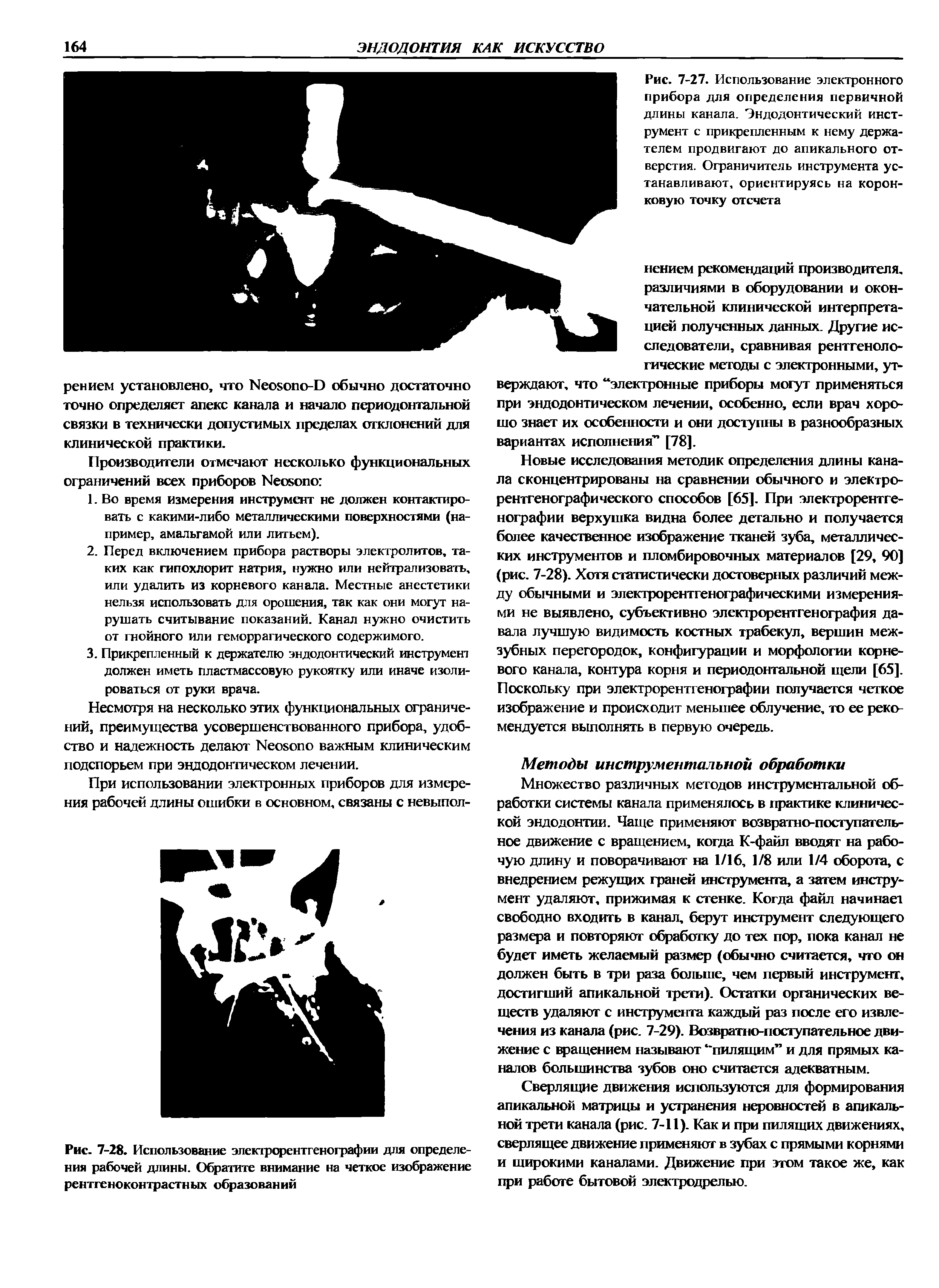 Рис. 7-28. Использование электрорентгенографии для определения рабочей длины. Обратите внимание на четкое изображение рентгеноконтрастных образований...