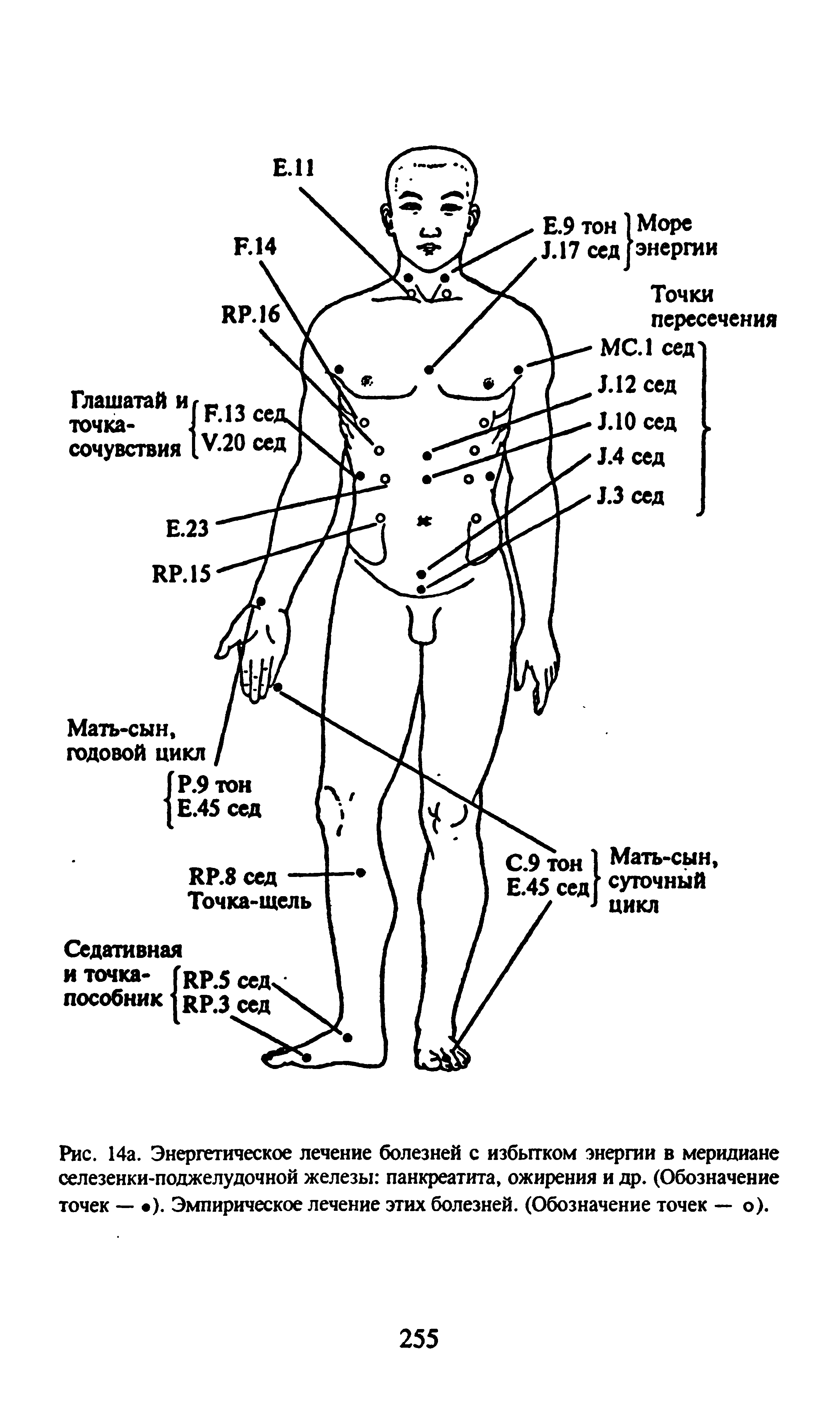 Рис. 14а. Энергетическое лечение болезней с избытком энергии в меридиане селезенки-поджелудочной железы панкреатита, ожирения и др. (Обозначение точек — ). Эмпирическое лечение этих болезней. (Обозначение точек — о).