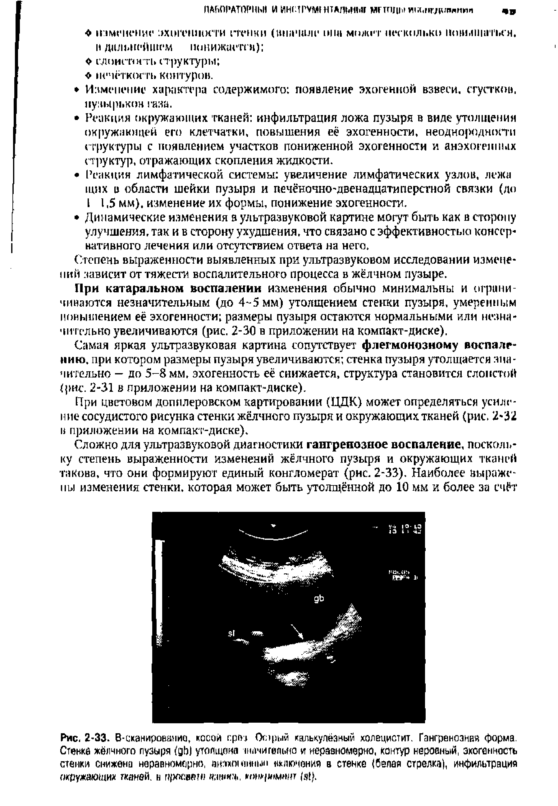 Рис. 2-33. В ска мировая на, косой срез Огэрый кцлькулёзный холецистит. Гангренозная форма. Стенка жёлчного пузыря (рЬ) утолщена Iнами гетто и неравномерно, контур неровный, эхогенность стенки снижена неравномерно, тпх<юн1нып включения в стенке (белая стрелка), инфильтрация окружающих тканей, в г1 кюаеп) чашка, конкргмивт...