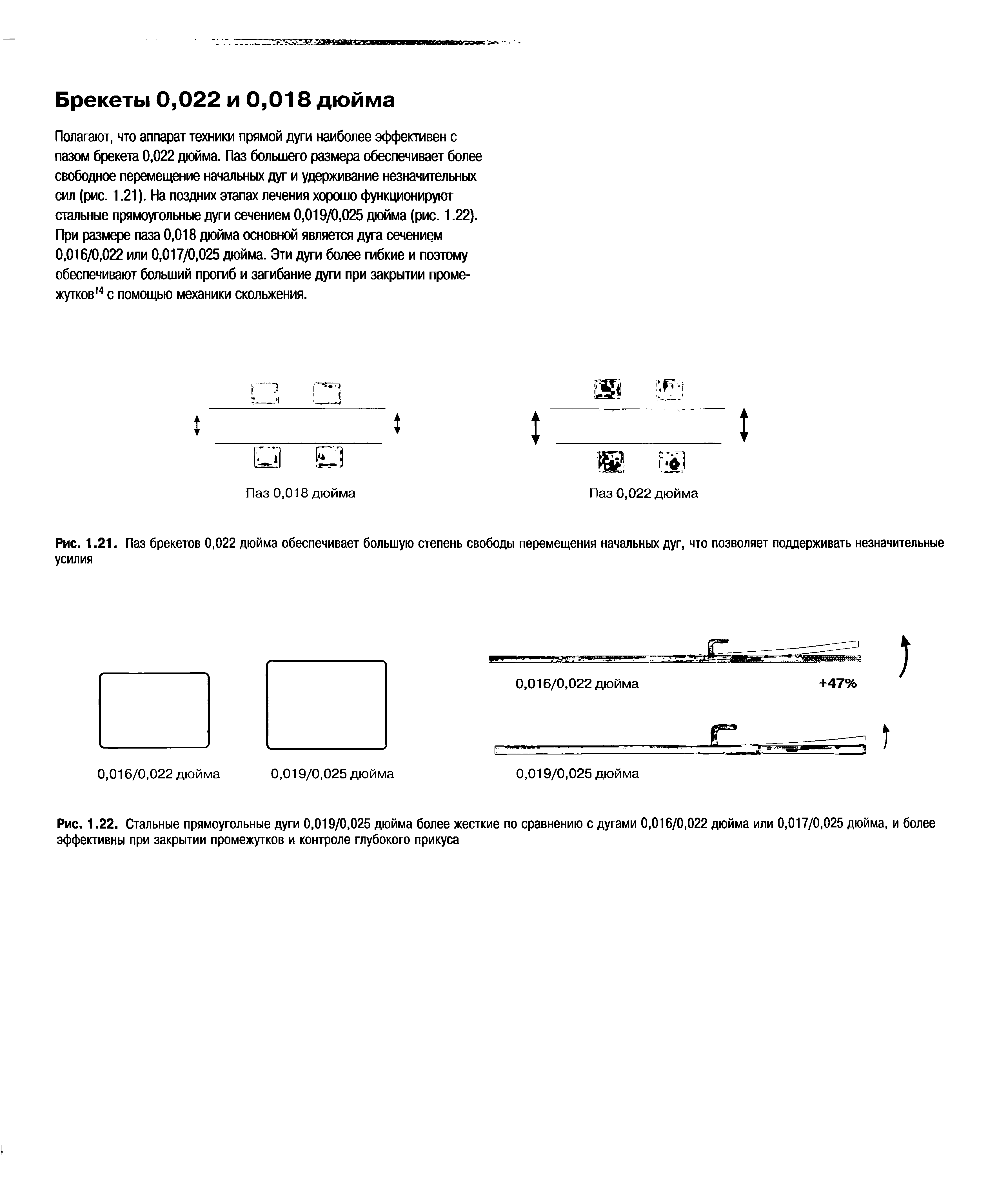 Рис. 1.22. Стальные прямоугольные дуги 0,019/0,025 дюйма более жесткие по сравнению с дугами 0,016/0,022 дюйма или 0,017/0,025 дюйма, и более эффективны при закрытии промежутков и контроле глубокого прикуса...