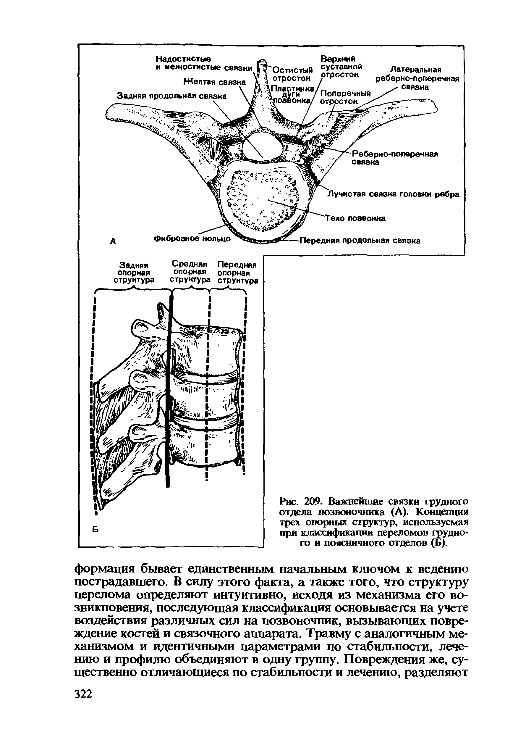 Рис. 209. Важнейшие связки грудного отдела позвоночника (А). Концепция трех опорных структур, используемая при классификации переломов грудного и поясничного отделов (Б).