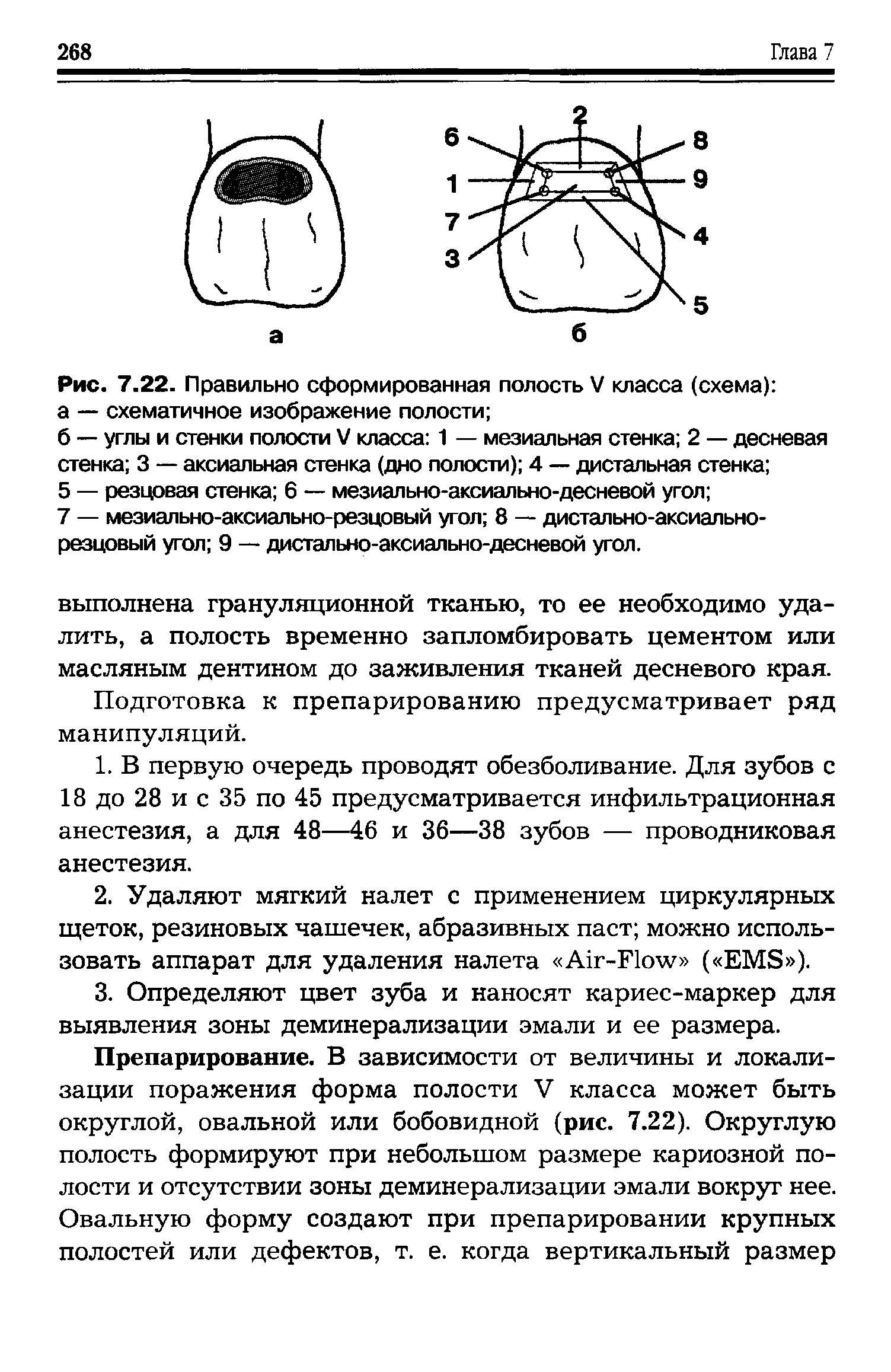 Рис. 7.22. Правильно сформированная полость V класса (схема) а — схематичное изображение полости ...