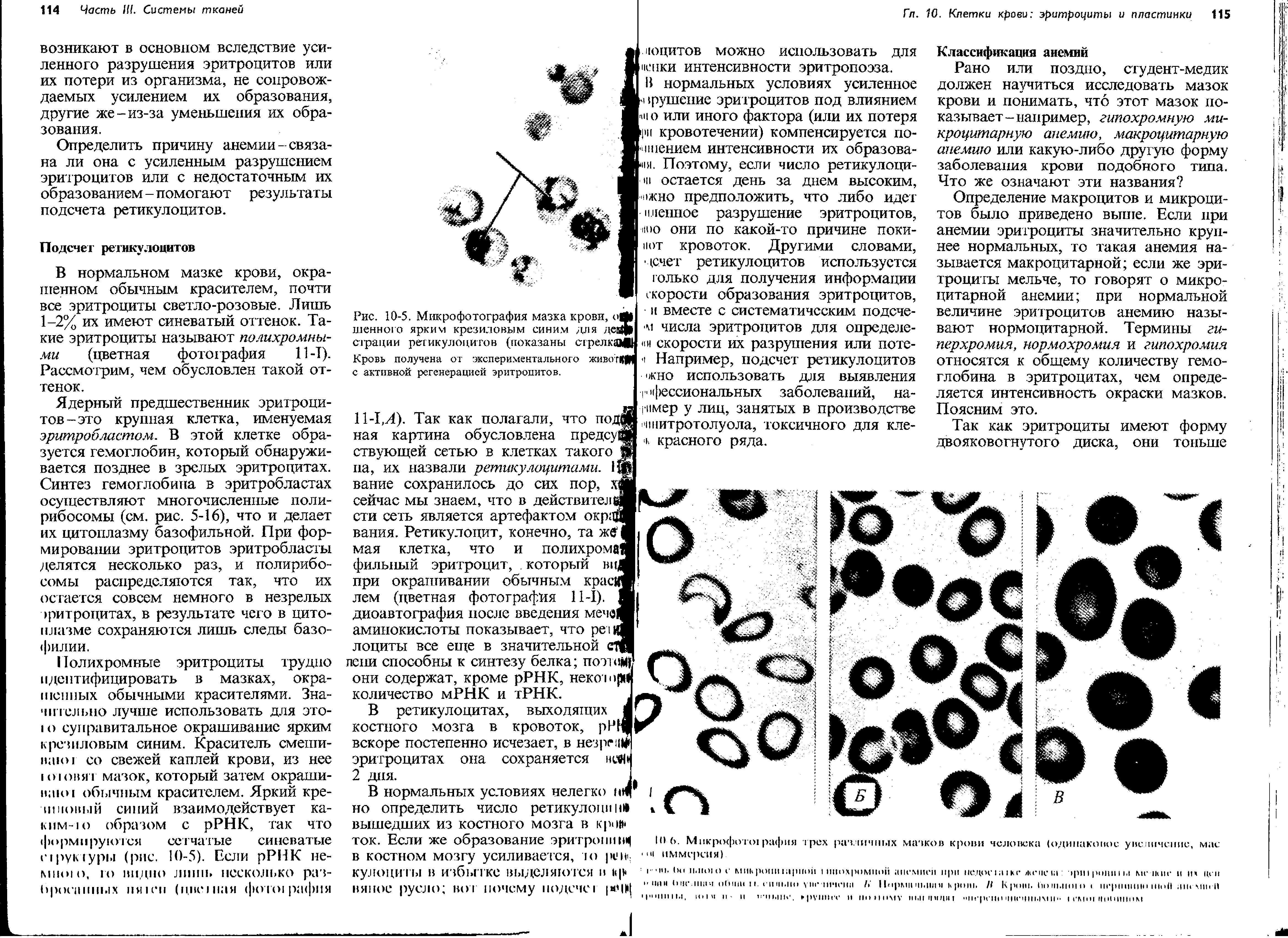 Рис. 10-5. Микрофотография мазка крови, о шейного ярким крезиловым синим для девф страции ретикулоцитов (показаны сгрелка Кровь получена от экспериментального живот , с активной регенерацией эритроцитов.